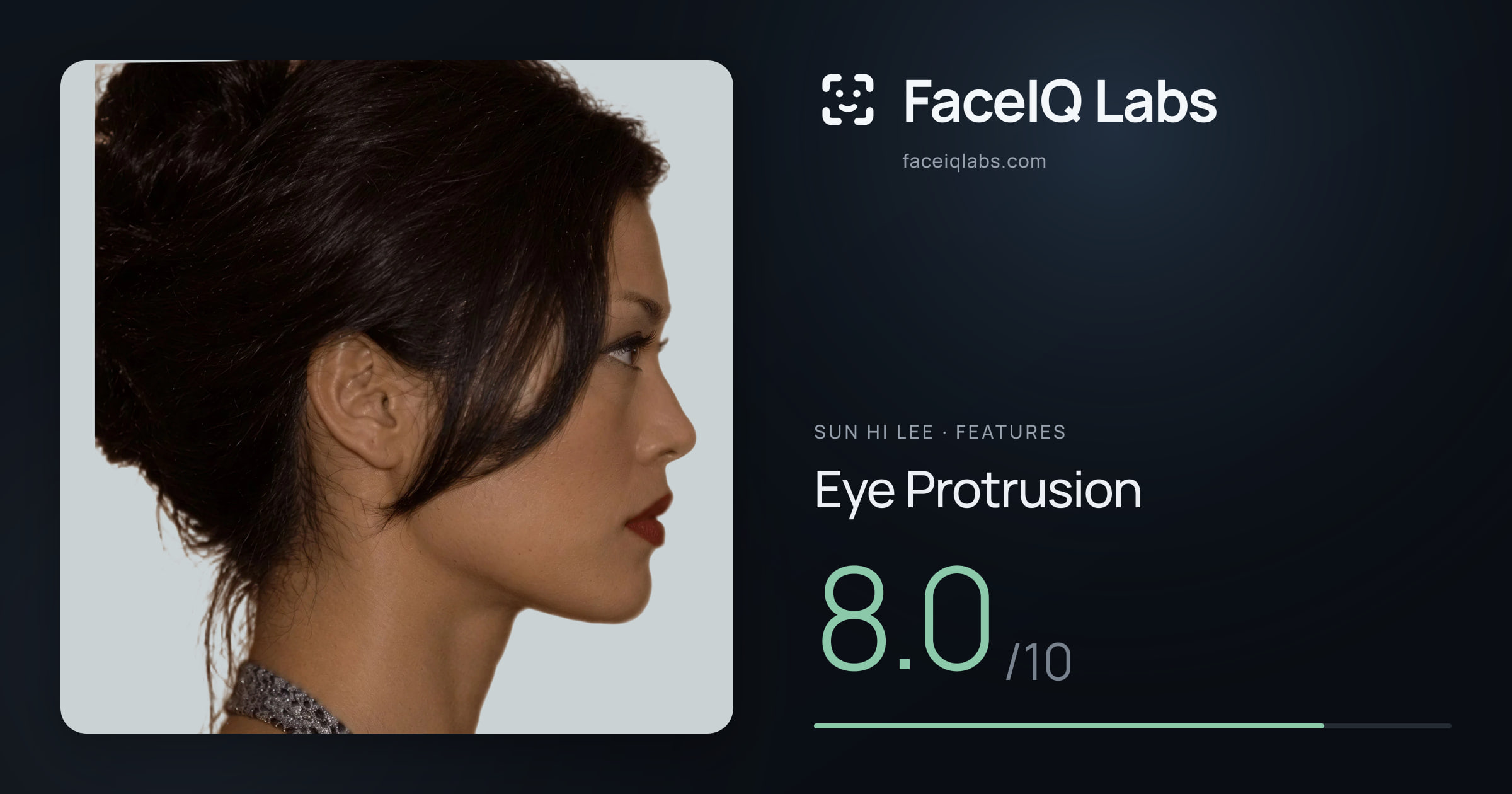 Sun Hi Lee Eye Protrusion: 8.0/10, drawn on the photo