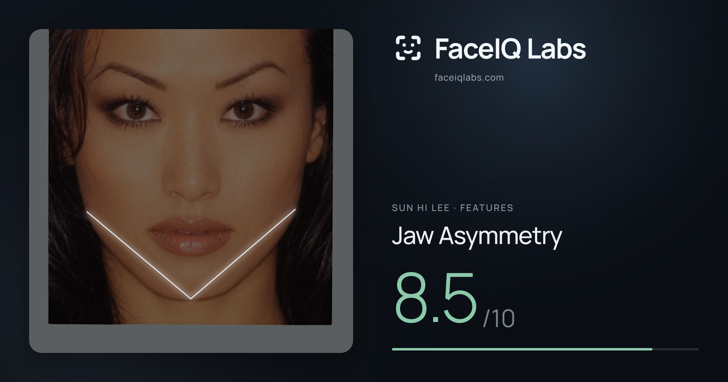 Sun Hi Lee Jaw Asymmetry: 8.5/10, drawn on the photo