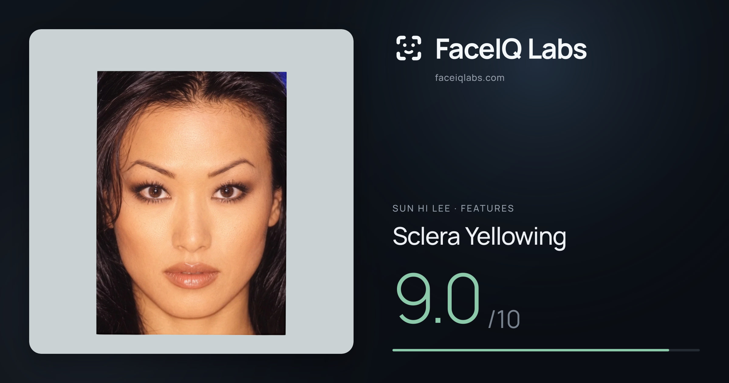 Sun Hi Lee Sclera Yellowing: 9.0/10, drawn on the photo