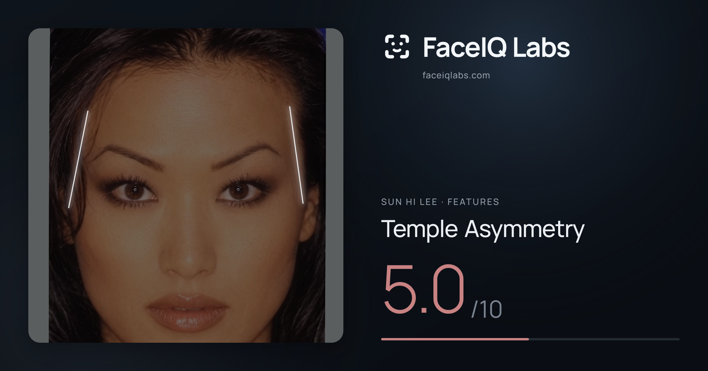 Sun Hi Lee Temple Asymmetry: 5.0/10, drawn on the photo