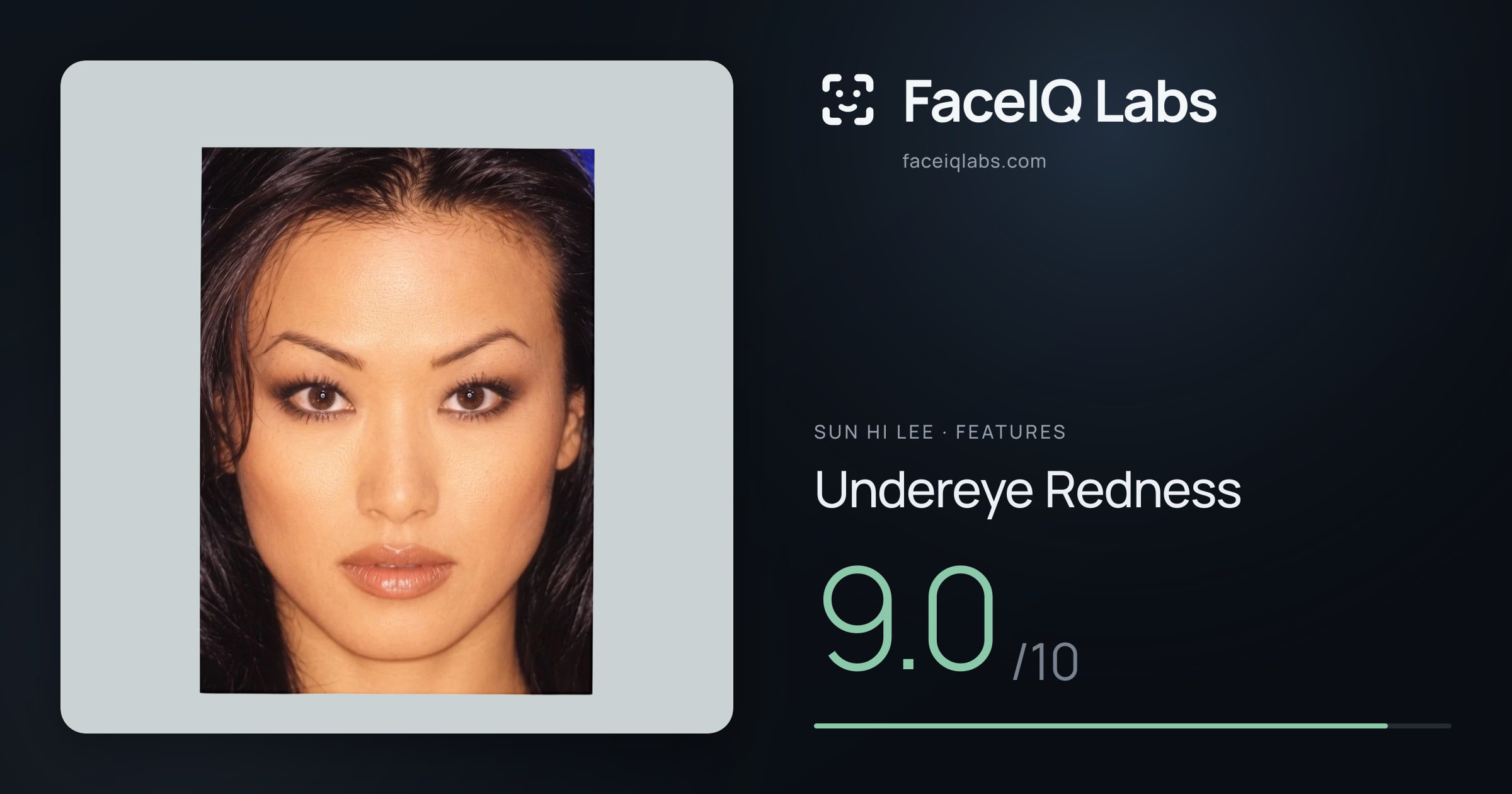 Sun Hi Lee Undereye Redness: 9.0/10, drawn on the photo