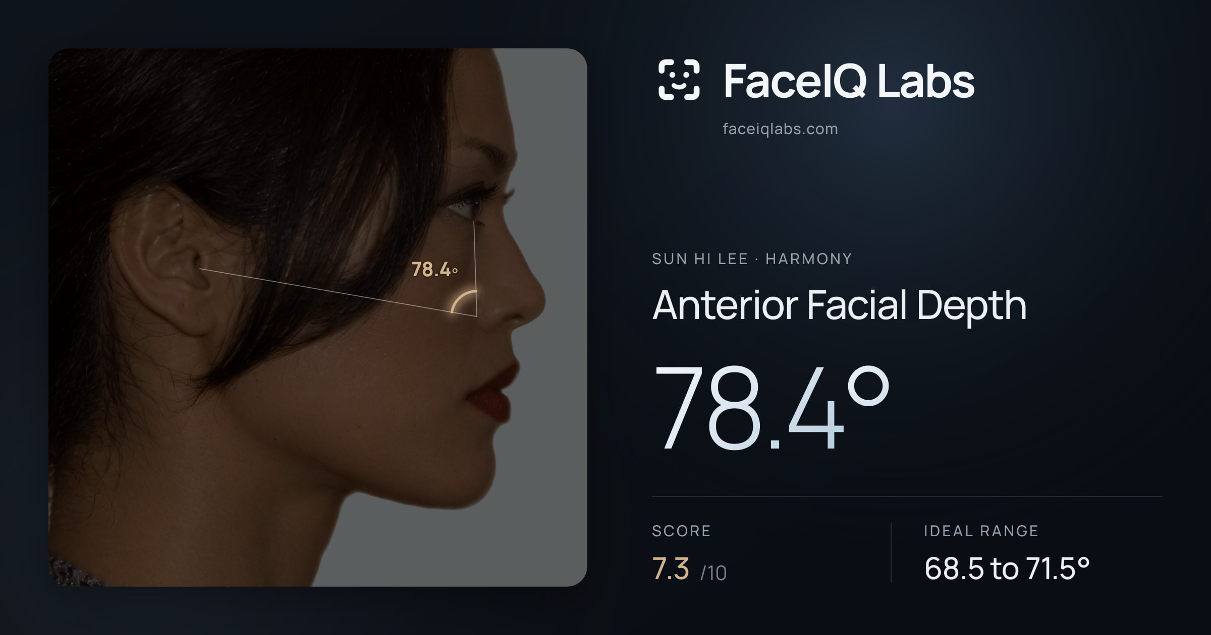 Sun Hi Lee Anterior Facial Depth: 78.4°, drawn on the photo