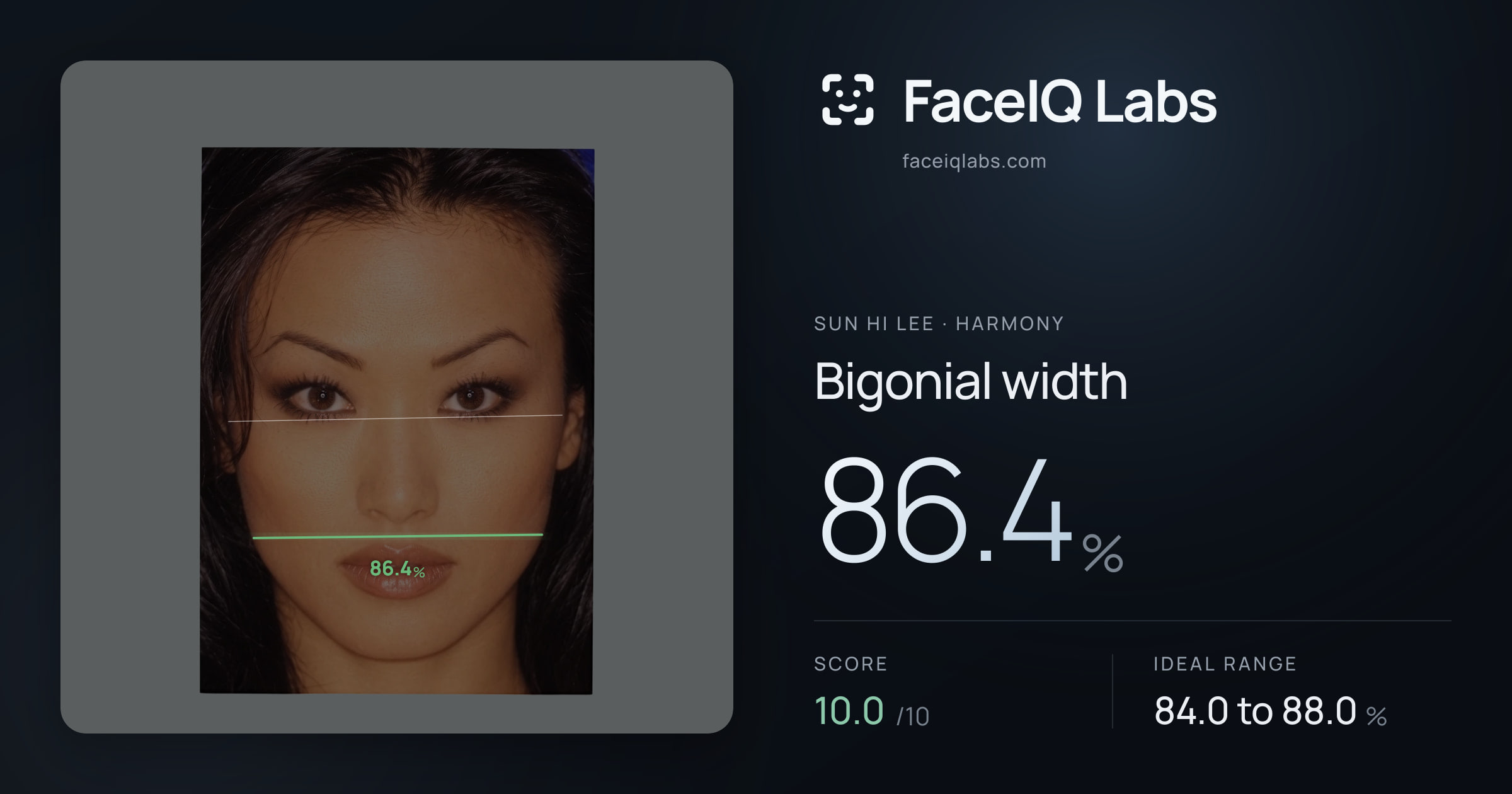 Sun Hi Lee Bigonial width: 86.4%, drawn on the photo