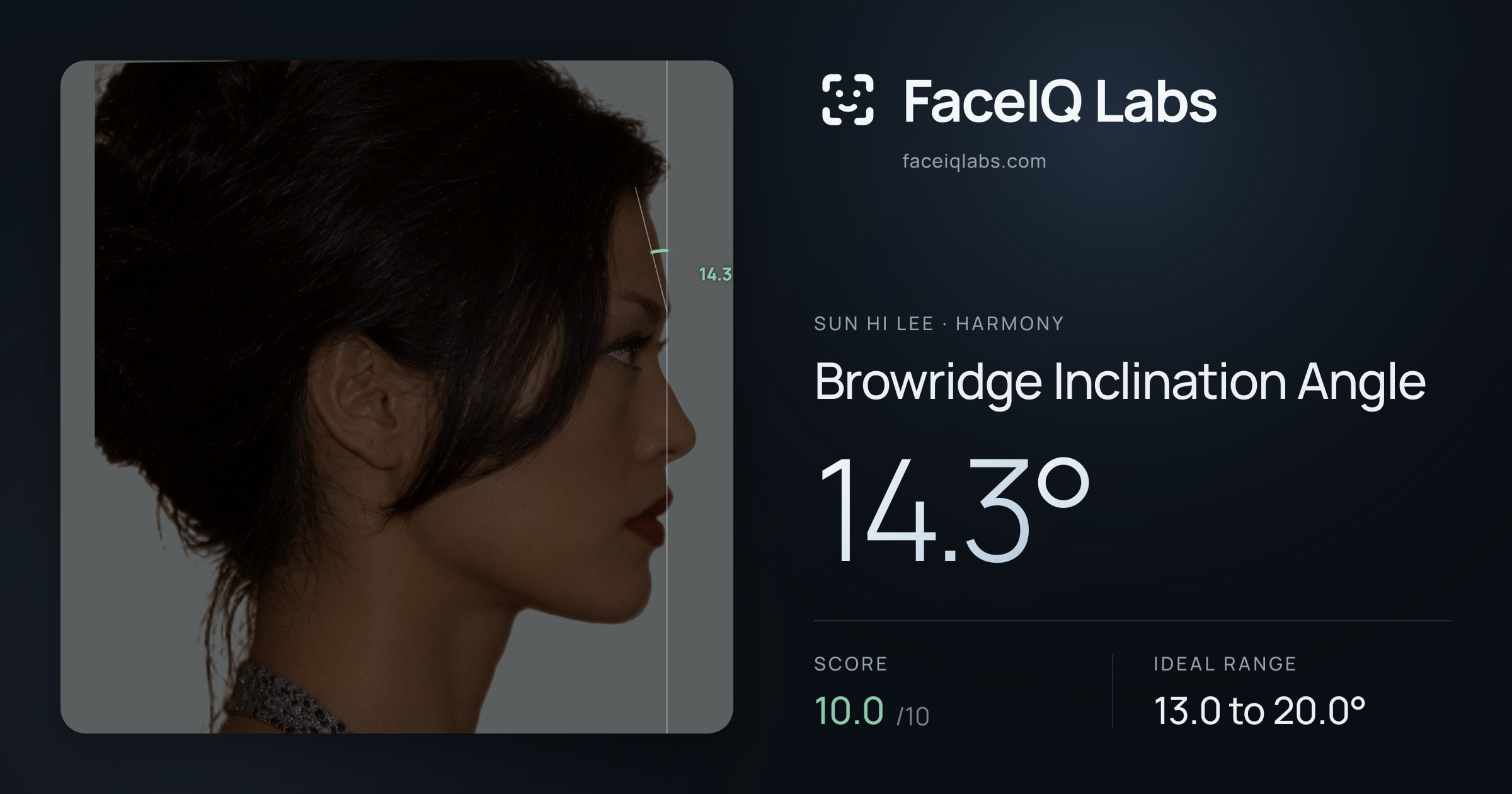 Sun Hi Lee Browridge Inclination Angle: 14.3°, drawn on the photo