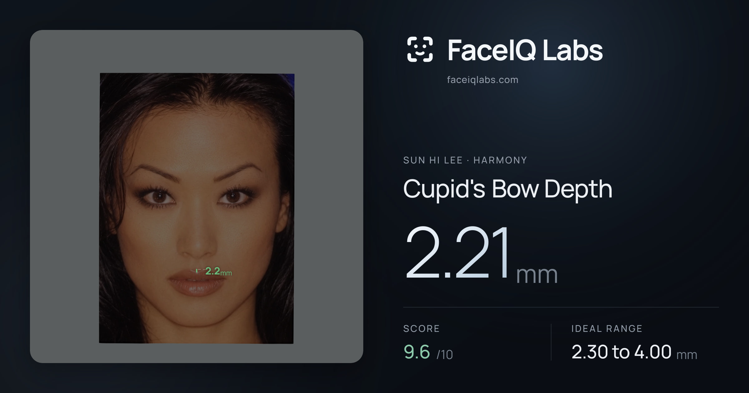 Sun Hi Lee Cupid's Bow Depth: 2.21mm, drawn on the photo