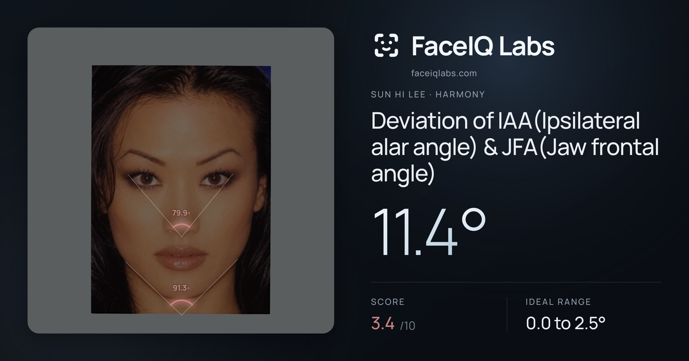 Sun Hi Lee Deviation of IAA(Ipsilateral alar angle) & JFA(Jaw frontal angle): 11.4°, drawn on the photo