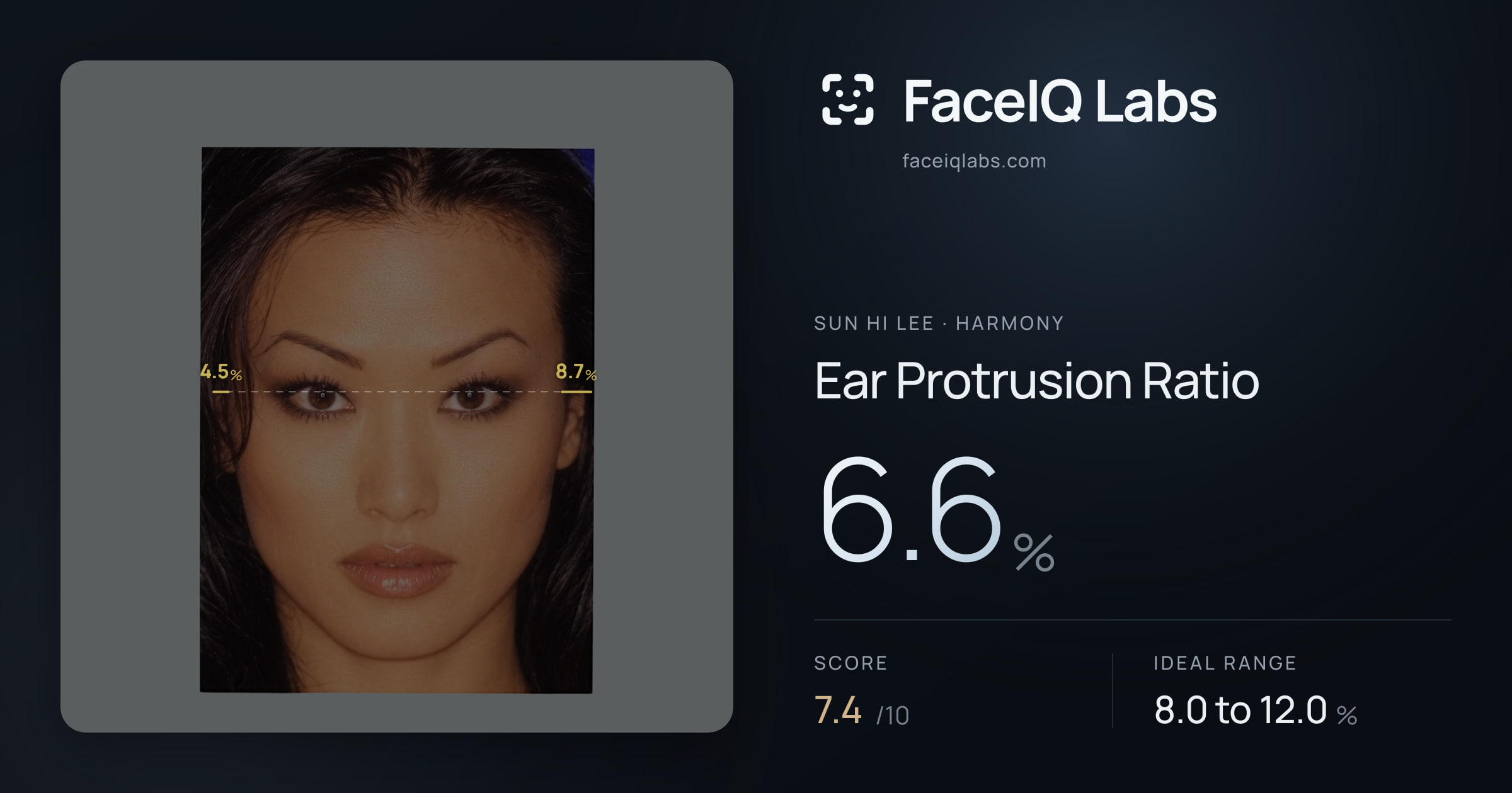 Sun Hi Lee Ear Protrusion Ratio: 6.6%, drawn on the photo