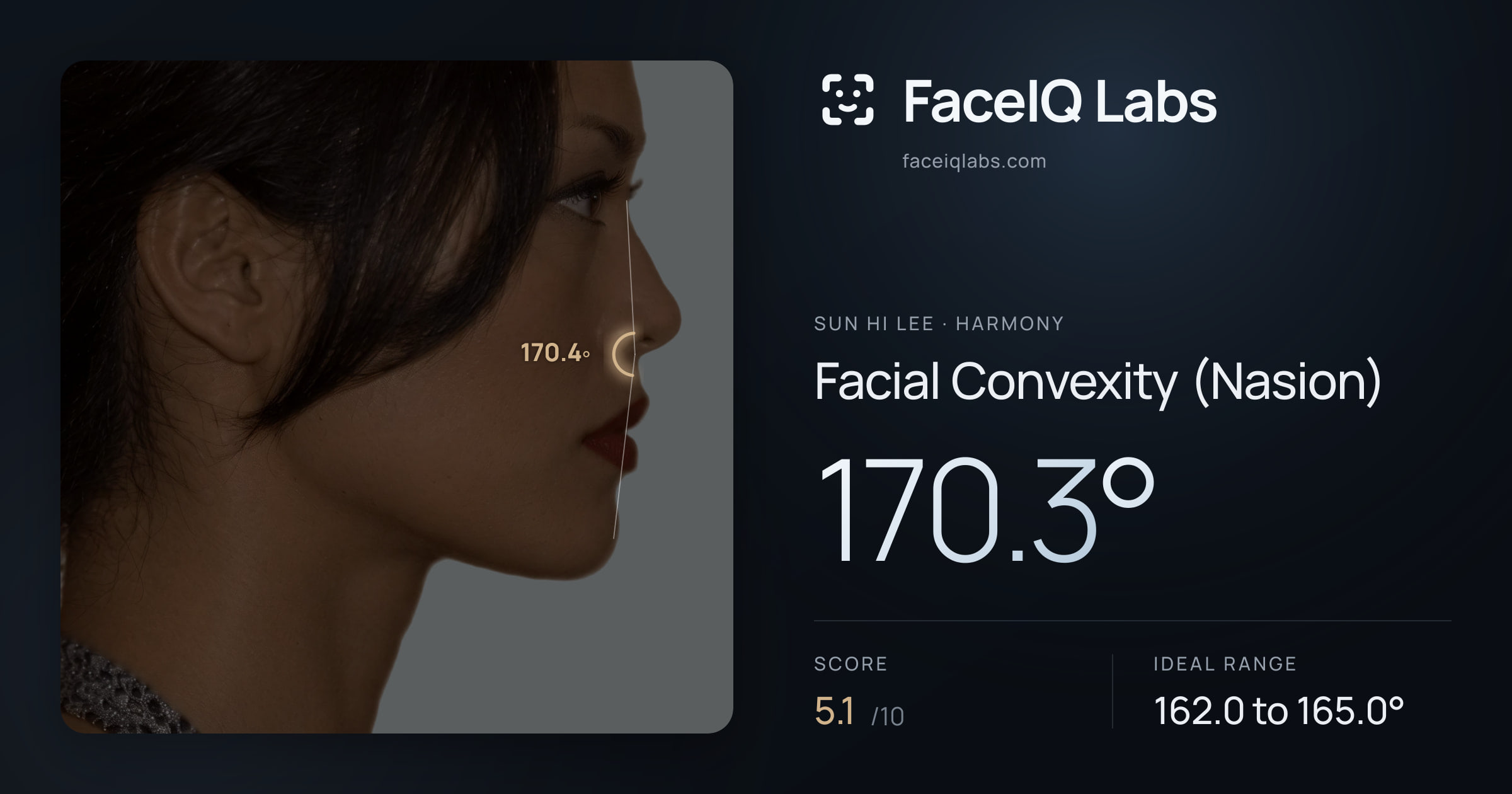 Sun Hi Lee Facial Convexity (Nasion): 170.3°, drawn on the photo