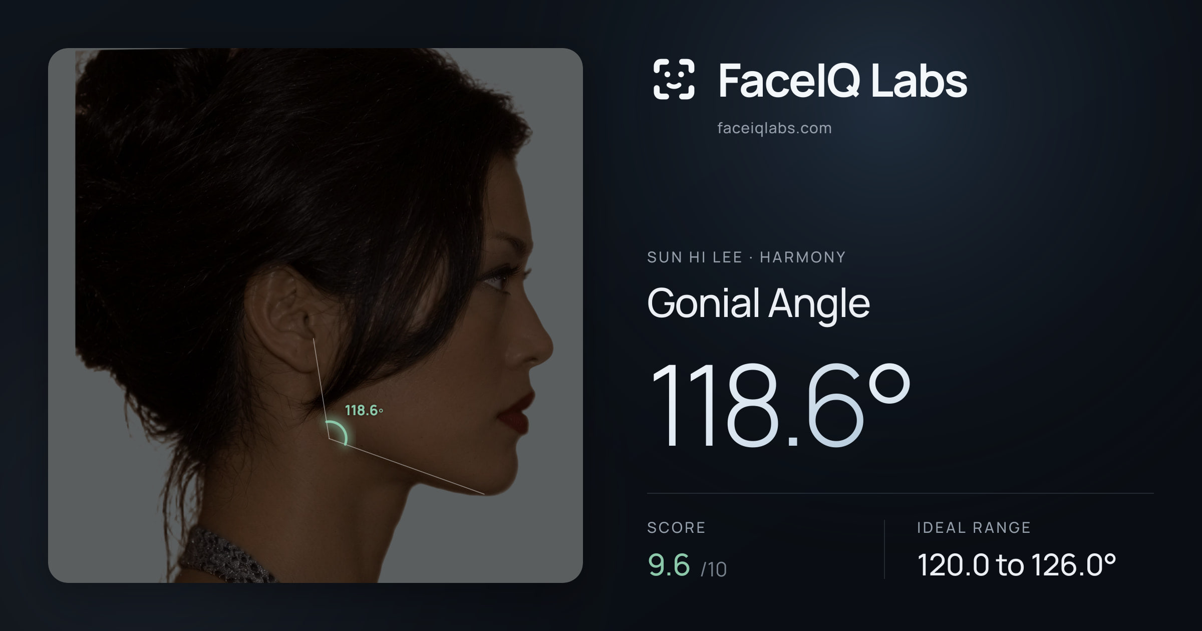 Sun Hi Lee Gonial Angle: 118.6°, drawn on the photo