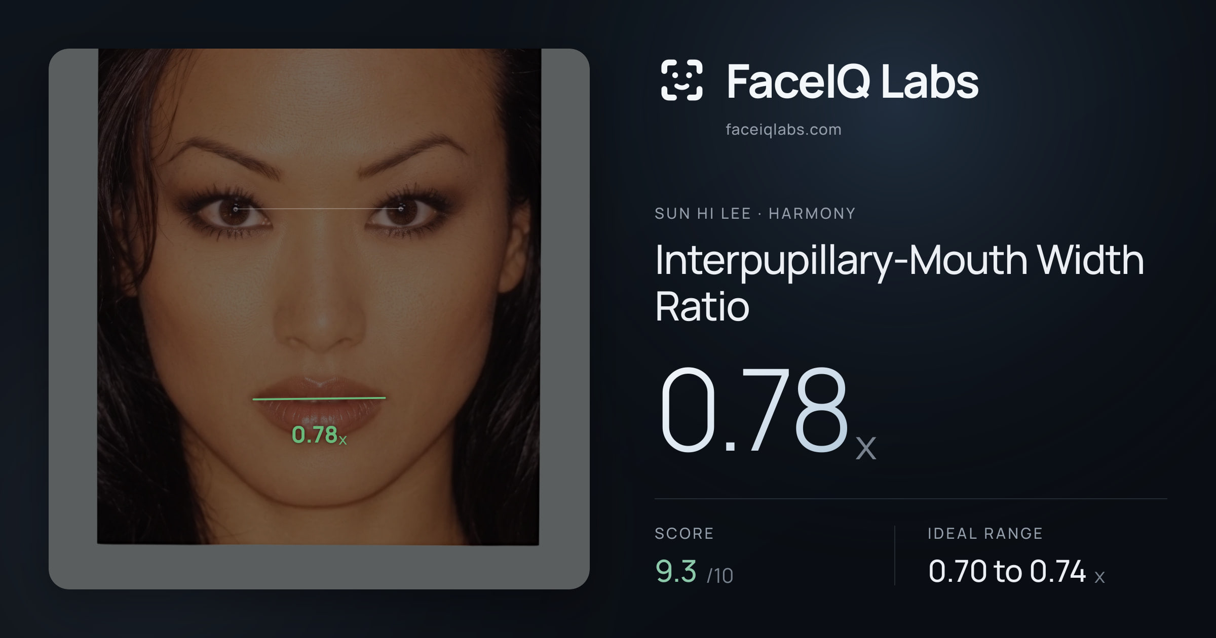 Sun Hi Lee Interpupillary-Mouth Width Ratio: 0.78x, drawn on the photo