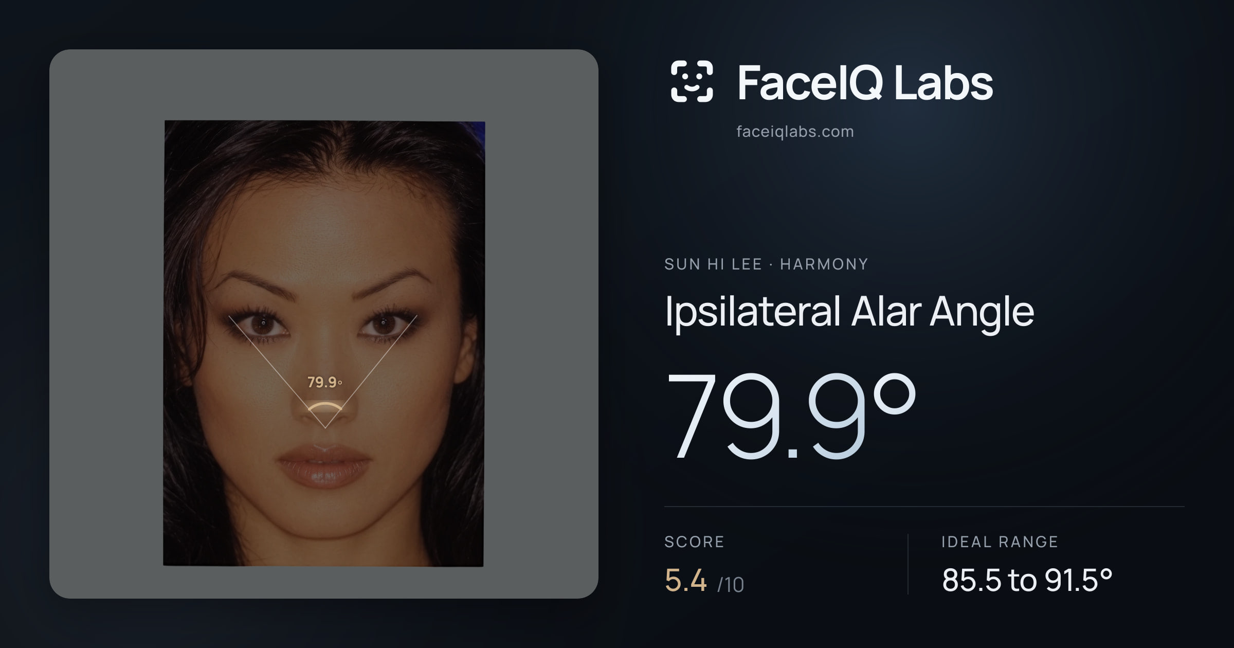 Sun Hi Lee Ipsilateral Alar Angle: 79.9°, drawn on the photo
