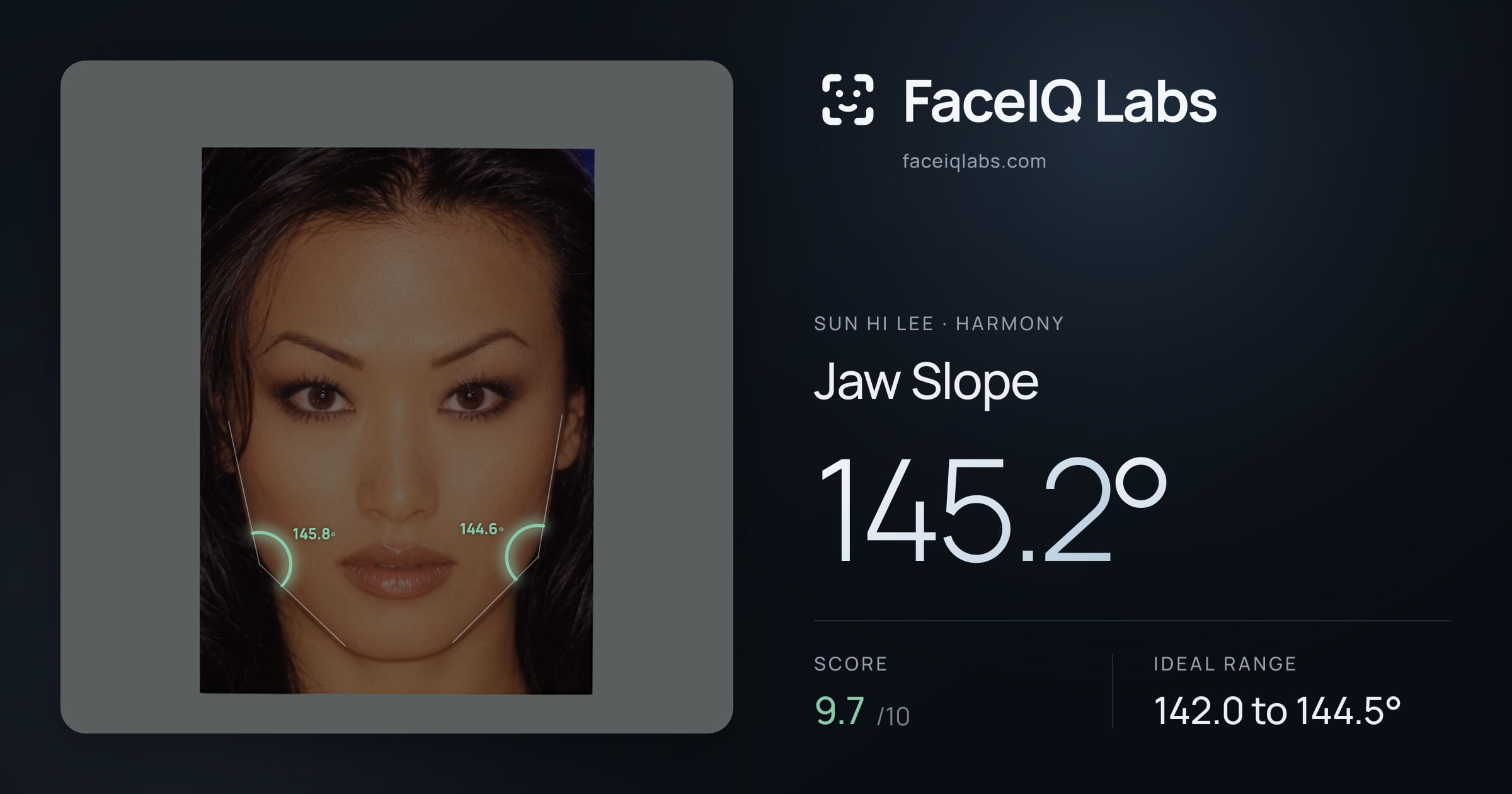 Sun Hi Lee Jaw Slope: 145.2°, drawn on the photo