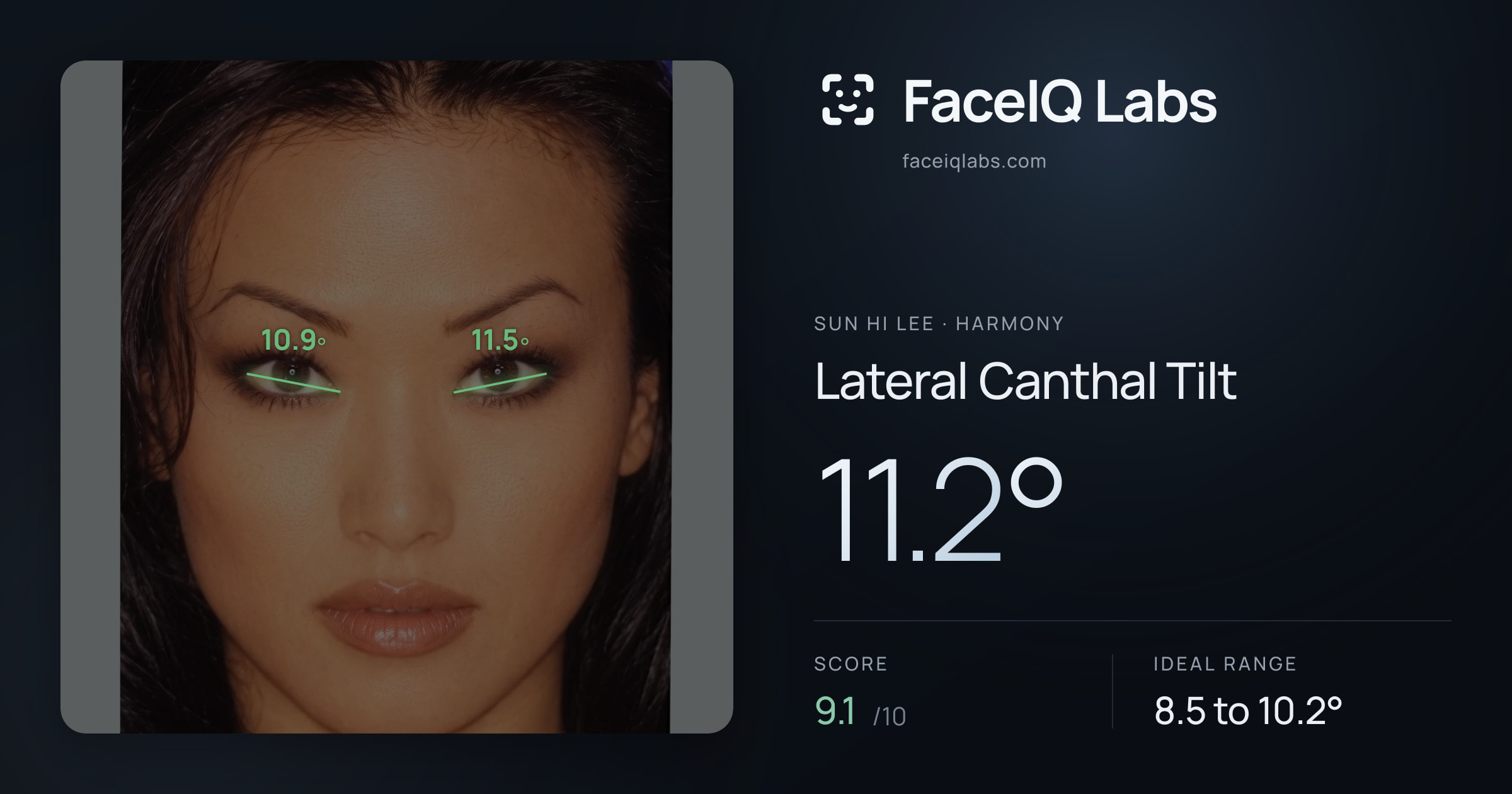 Sun Hi Lee Lateral Canthal Tilt: 11.2°, drawn on the photo