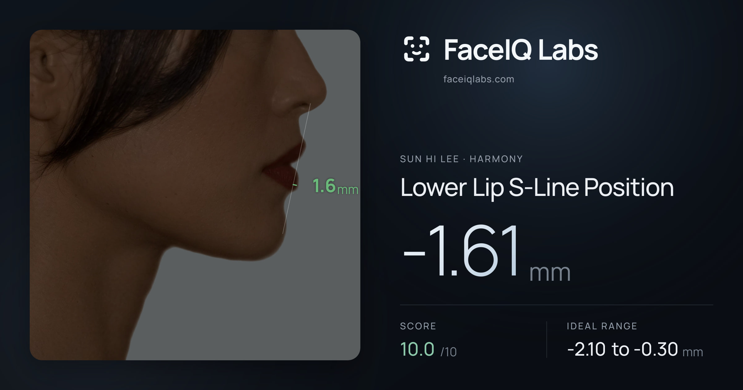Sun Hi Lee Lower Lip S-Line Position: -1.61mm, drawn on the photo