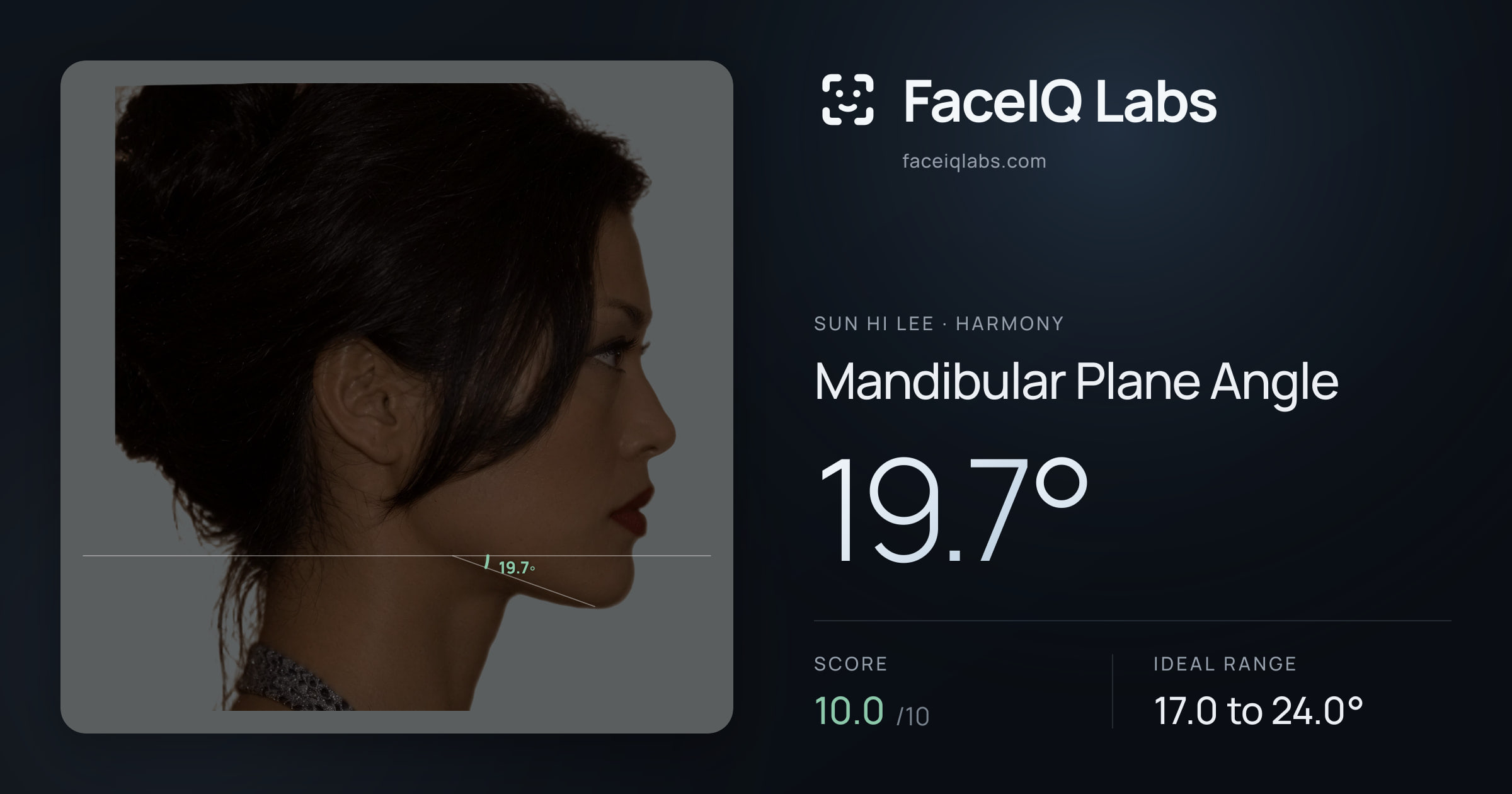 Sun Hi Lee Mandibular Plane Angle: 19.7°, drawn on the photo