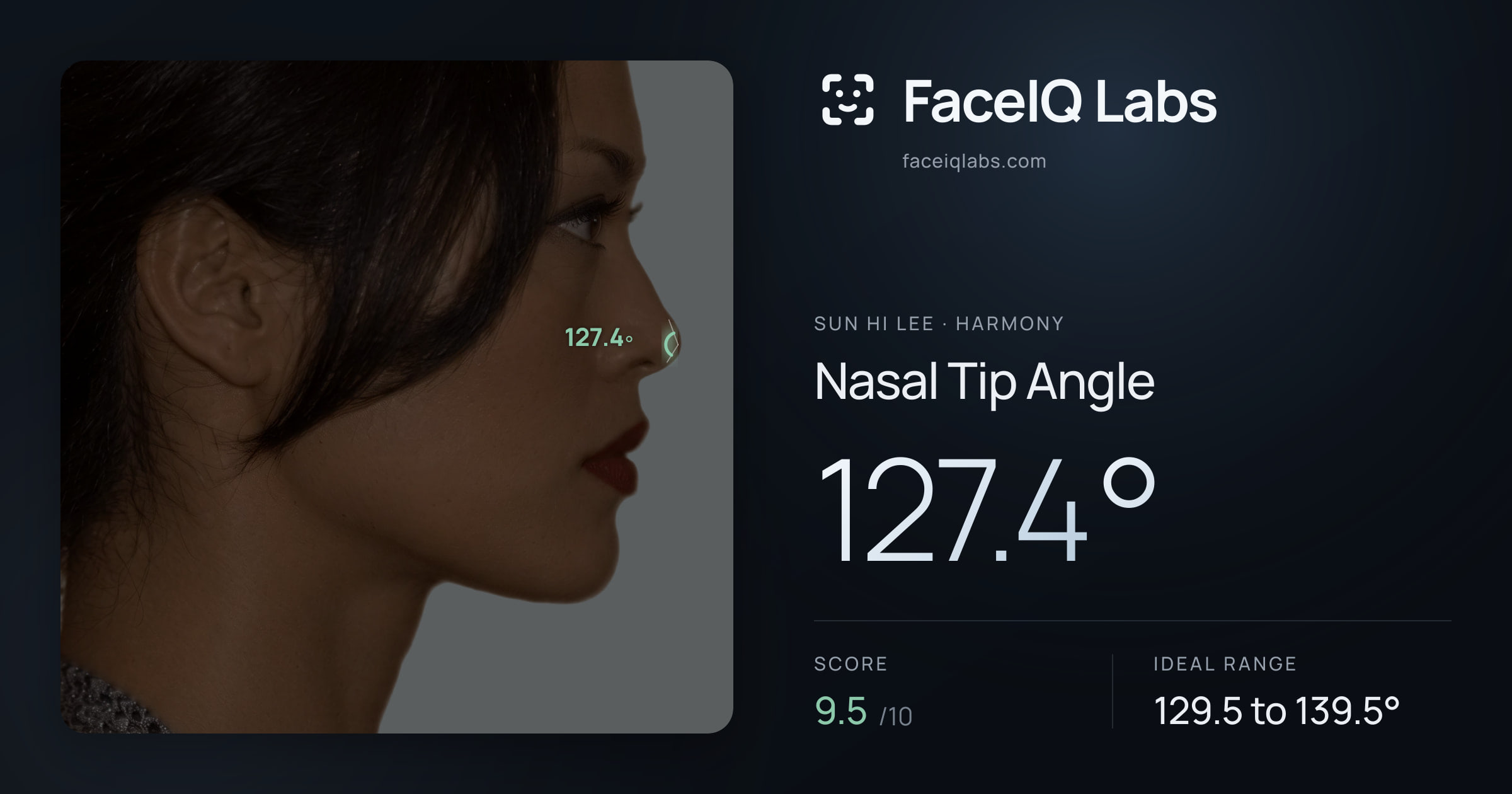 Sun Hi Lee Nasal Tip Angle: 127.4°, drawn on the photo