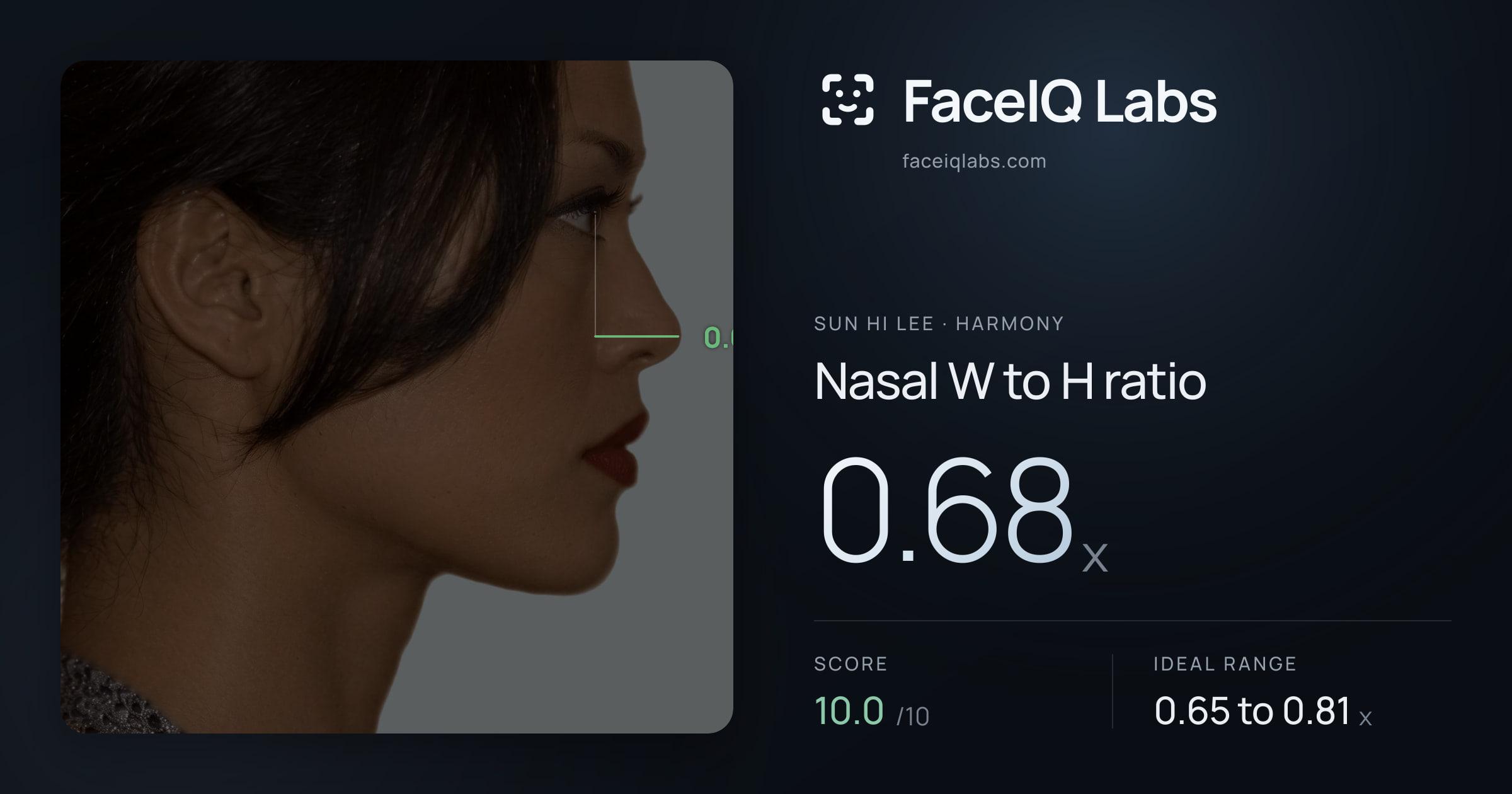 Sun Hi Lee Nasal W to H ratio: 0.68x, drawn on the photo