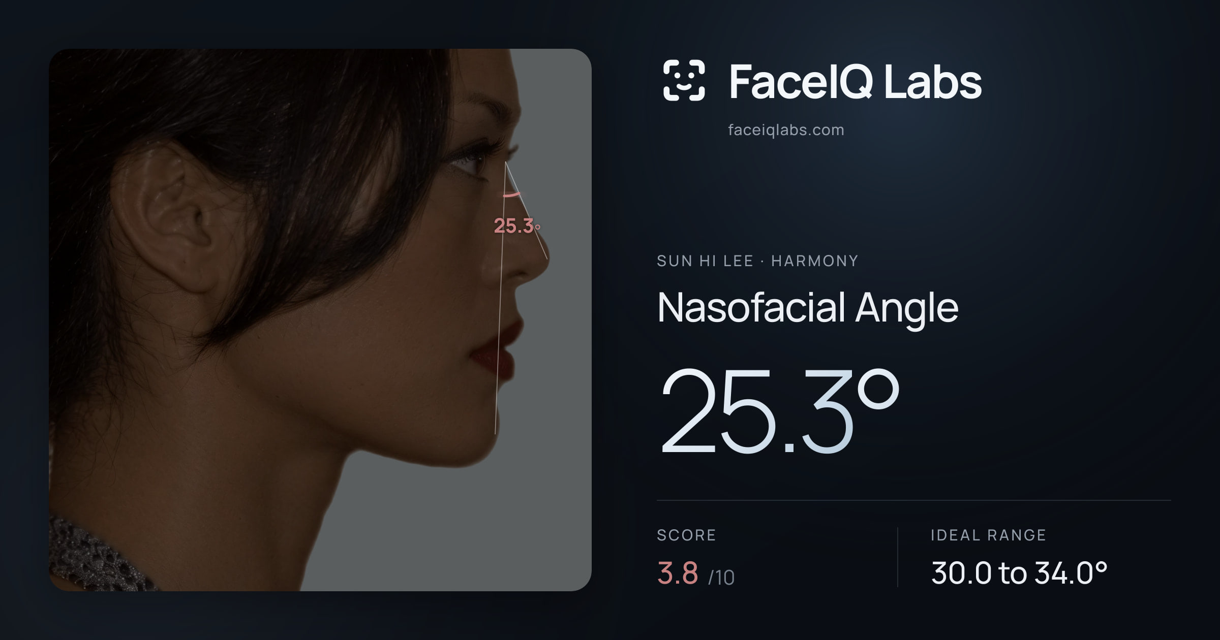 Sun Hi Lee Nasofacial Angle: 25.3°, drawn on the photo