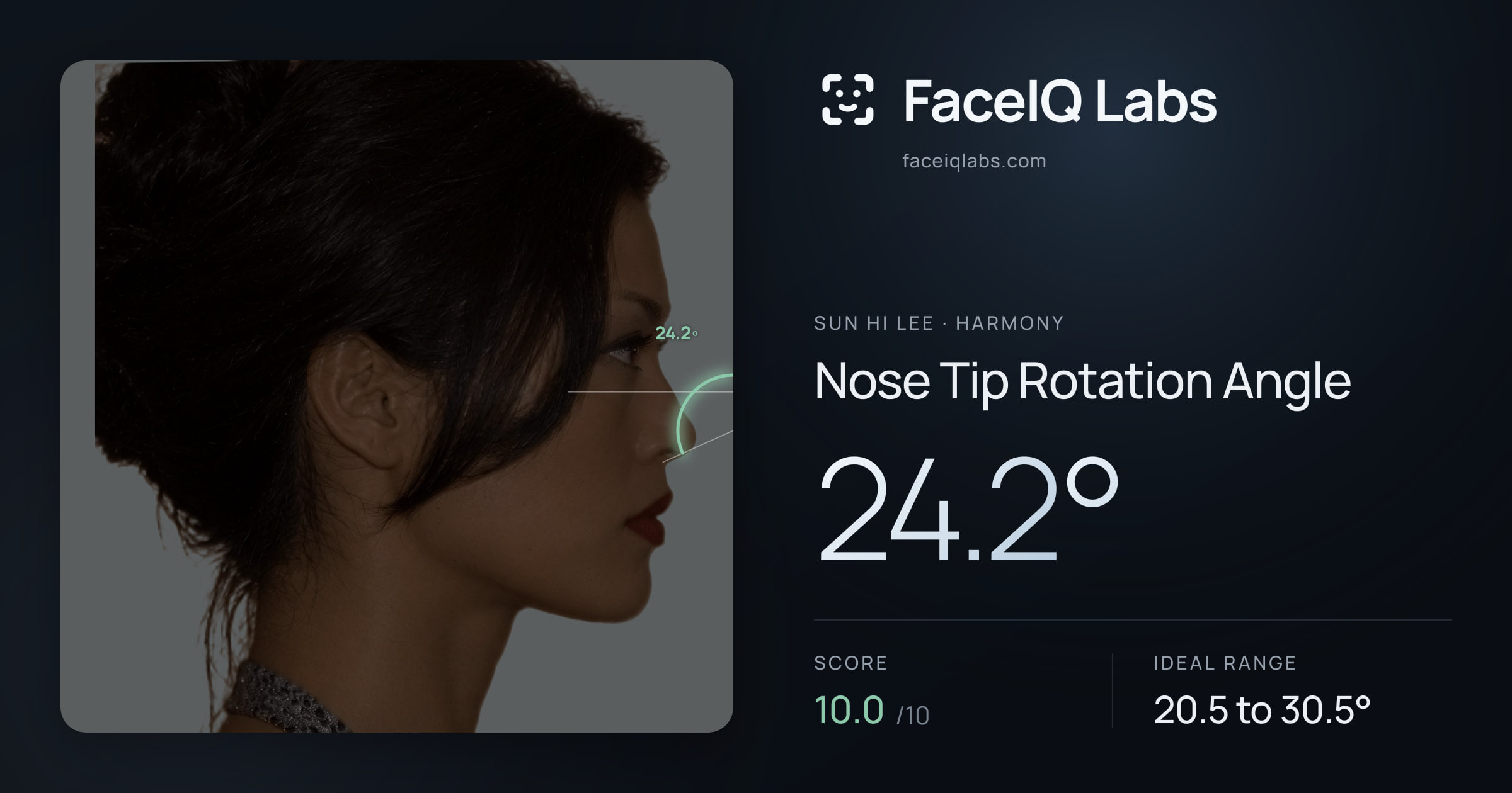 Sun Hi Lee Nose Tip Rotation Angle: 24.2°, drawn on the photo