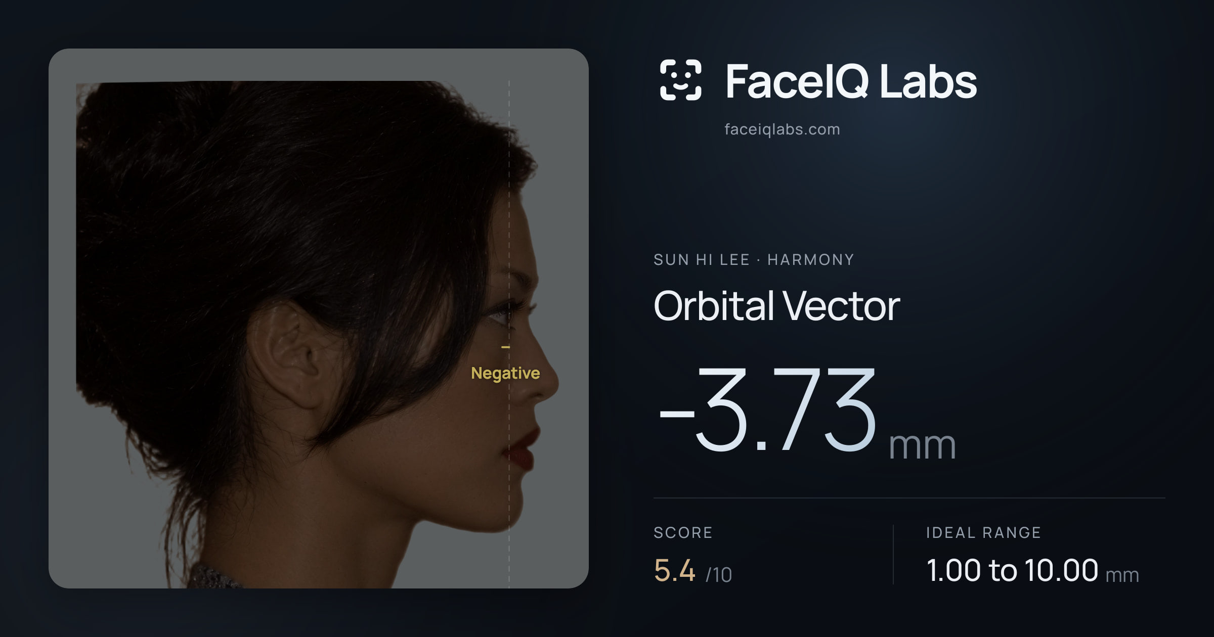 Sun Hi Lee Orbital Vector: -3.73mm, drawn on the photo
