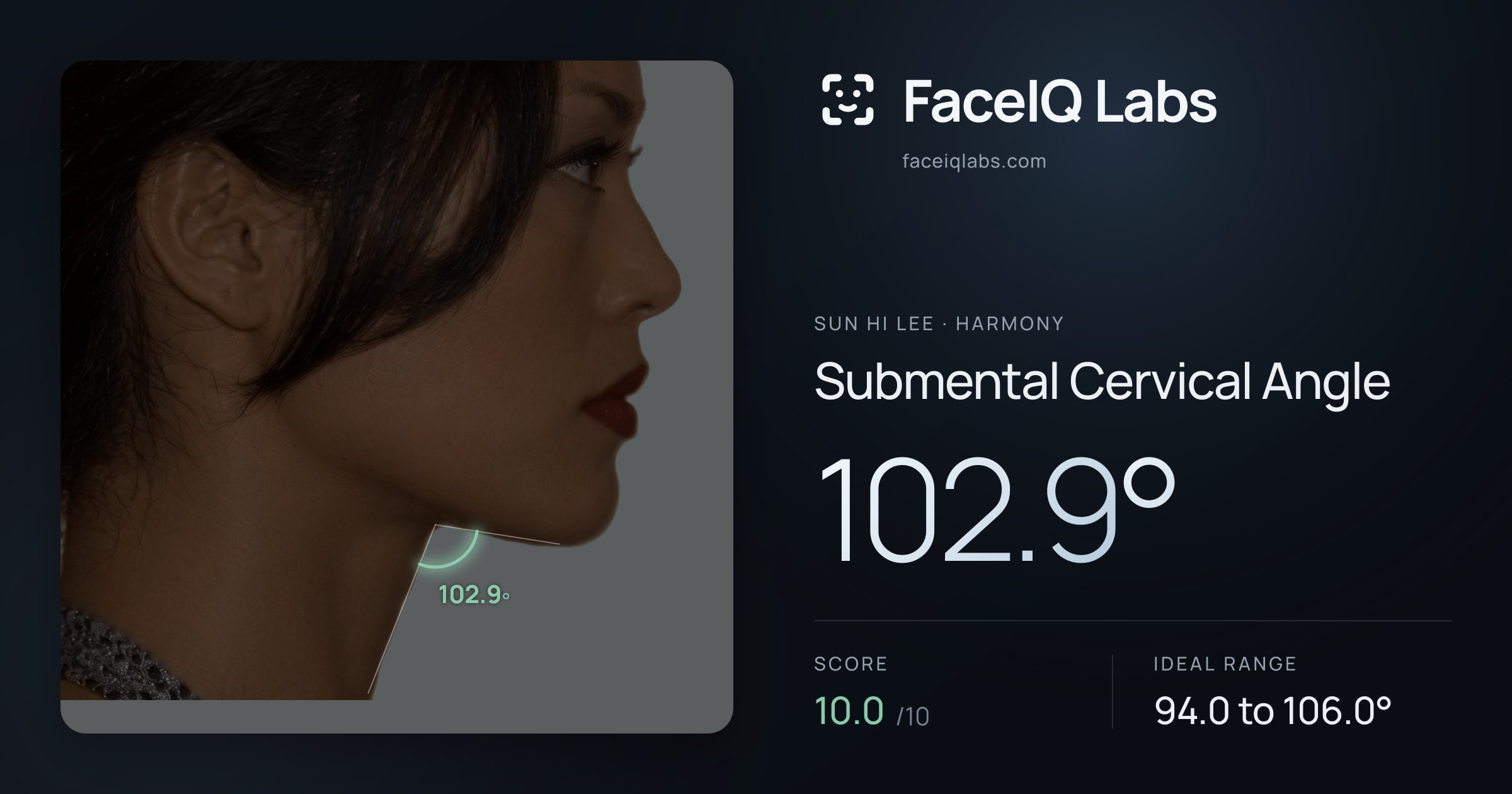 Sun Hi Lee Submental Cervical Angle: 102.9°, drawn on the photo
