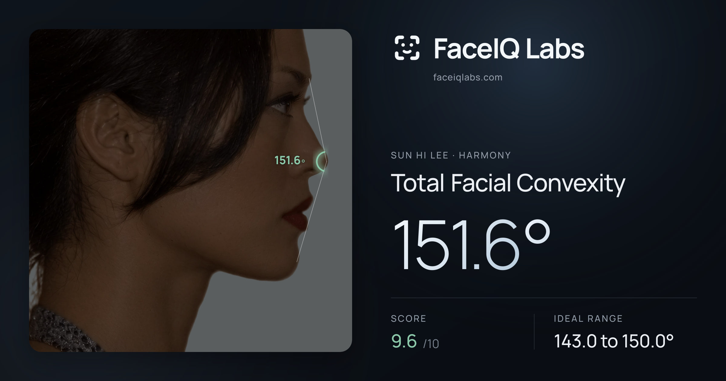 Sun Hi Lee Total Facial Convexity: 151.6°, drawn on the photo