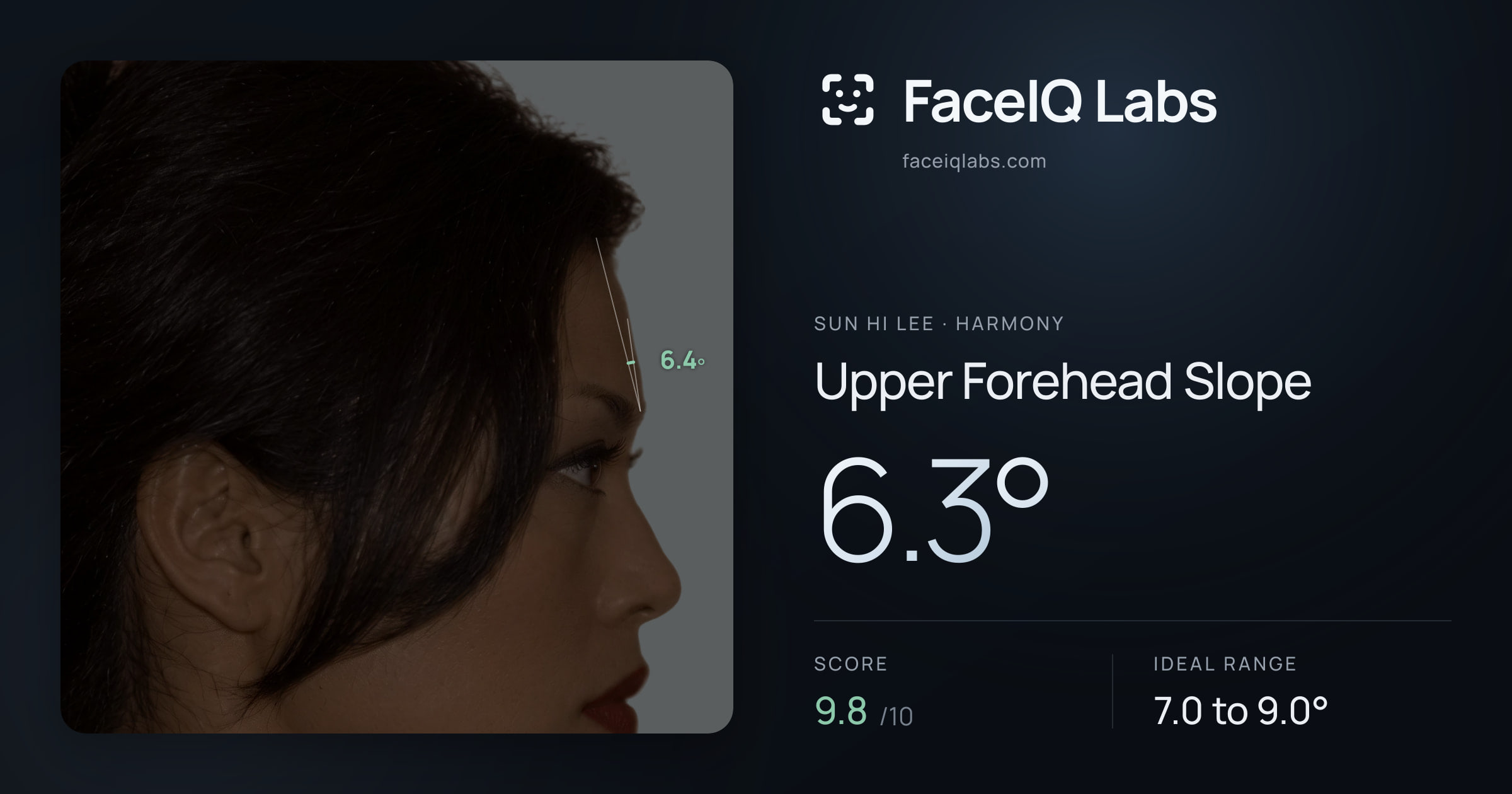 Sun Hi Lee Upper Forehead Slope: 6.3°, drawn on the photo