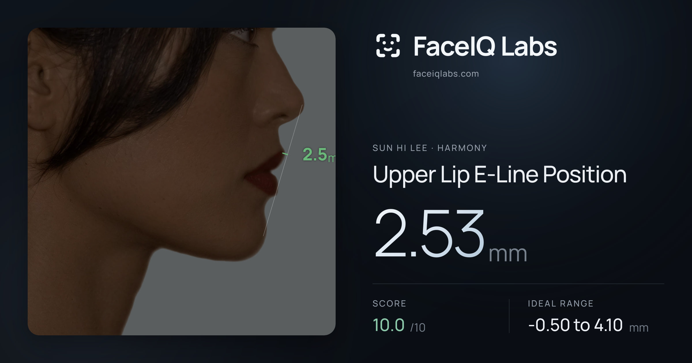 Sun Hi Lee Upper Lip E-Line Position: 2.53mm, drawn on the photo