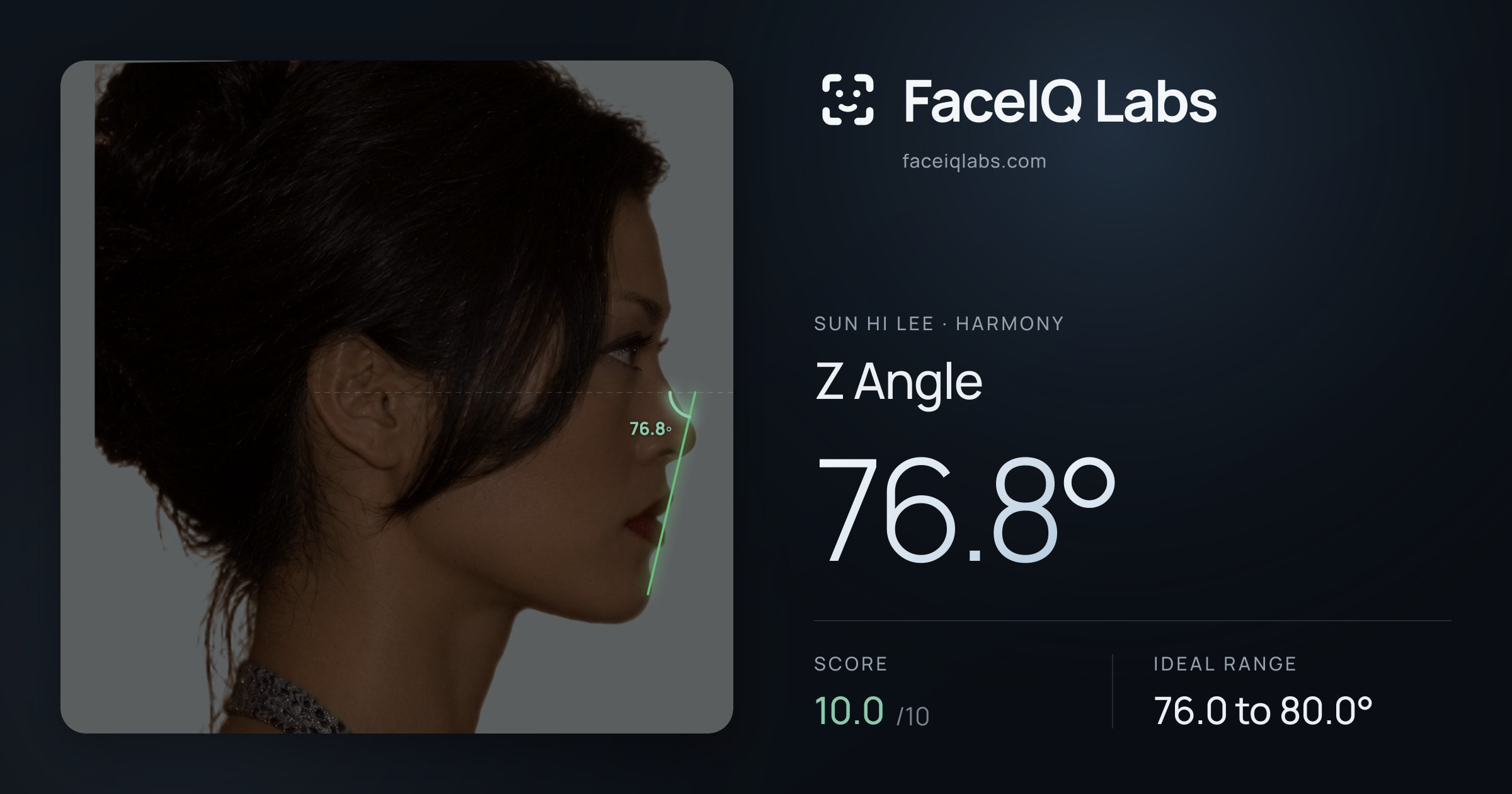 Sun Hi Lee Z Angle: 76.8°, drawn on the photo