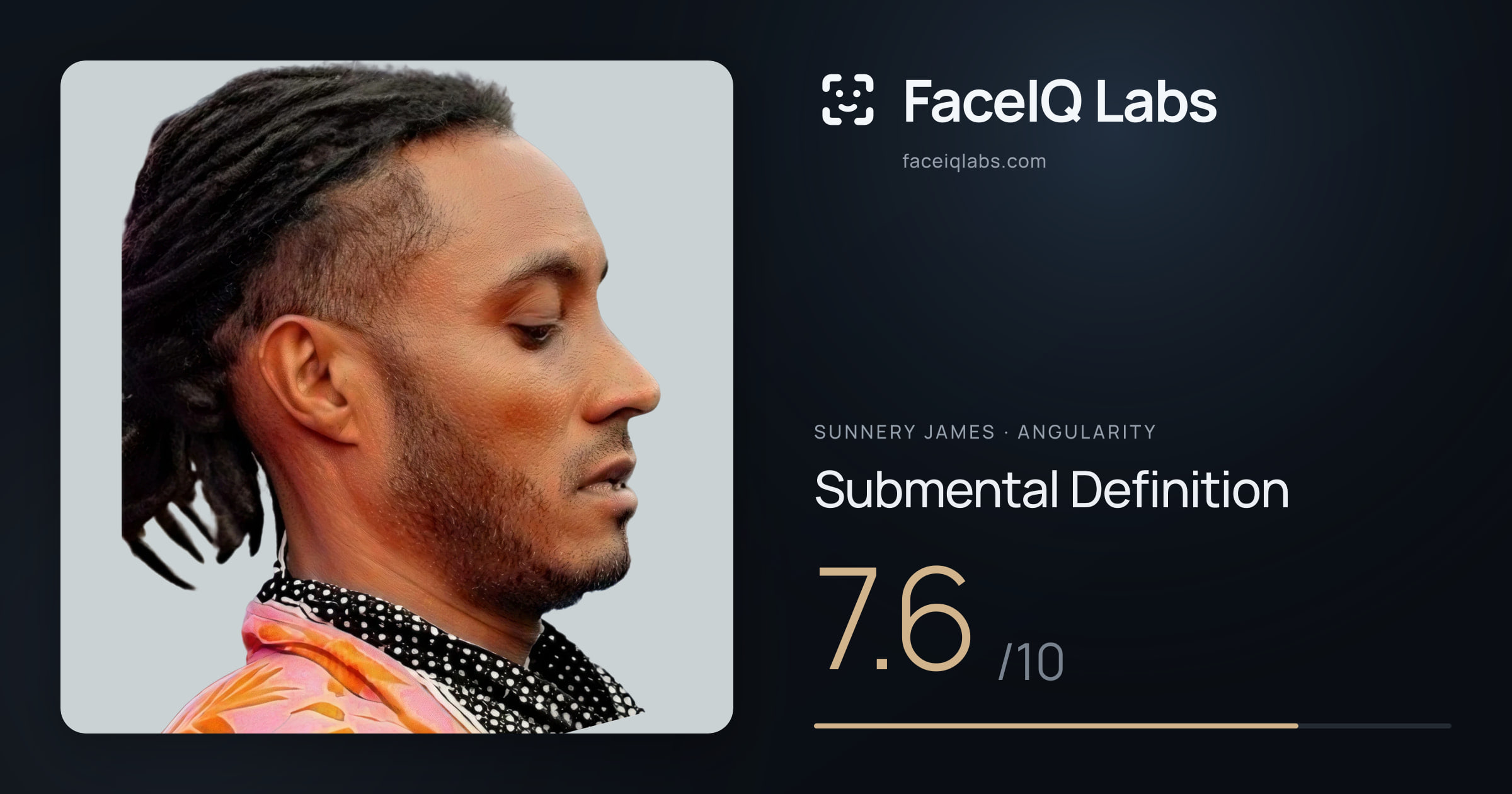 Sunnery James Submental Definition: 7.6/10, drawn on the photo