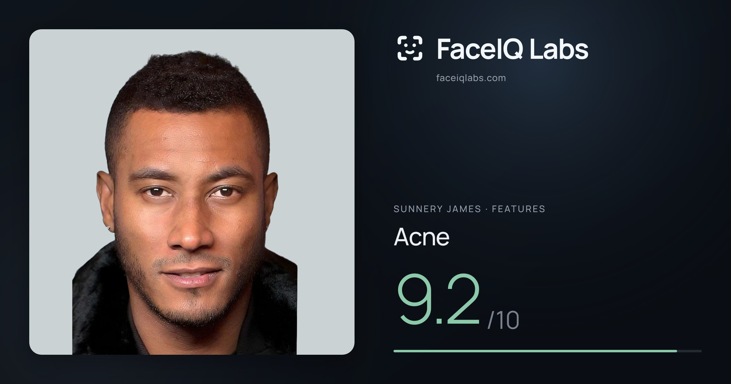 Sunnery James Acne: 9.2/10, drawn on the photo