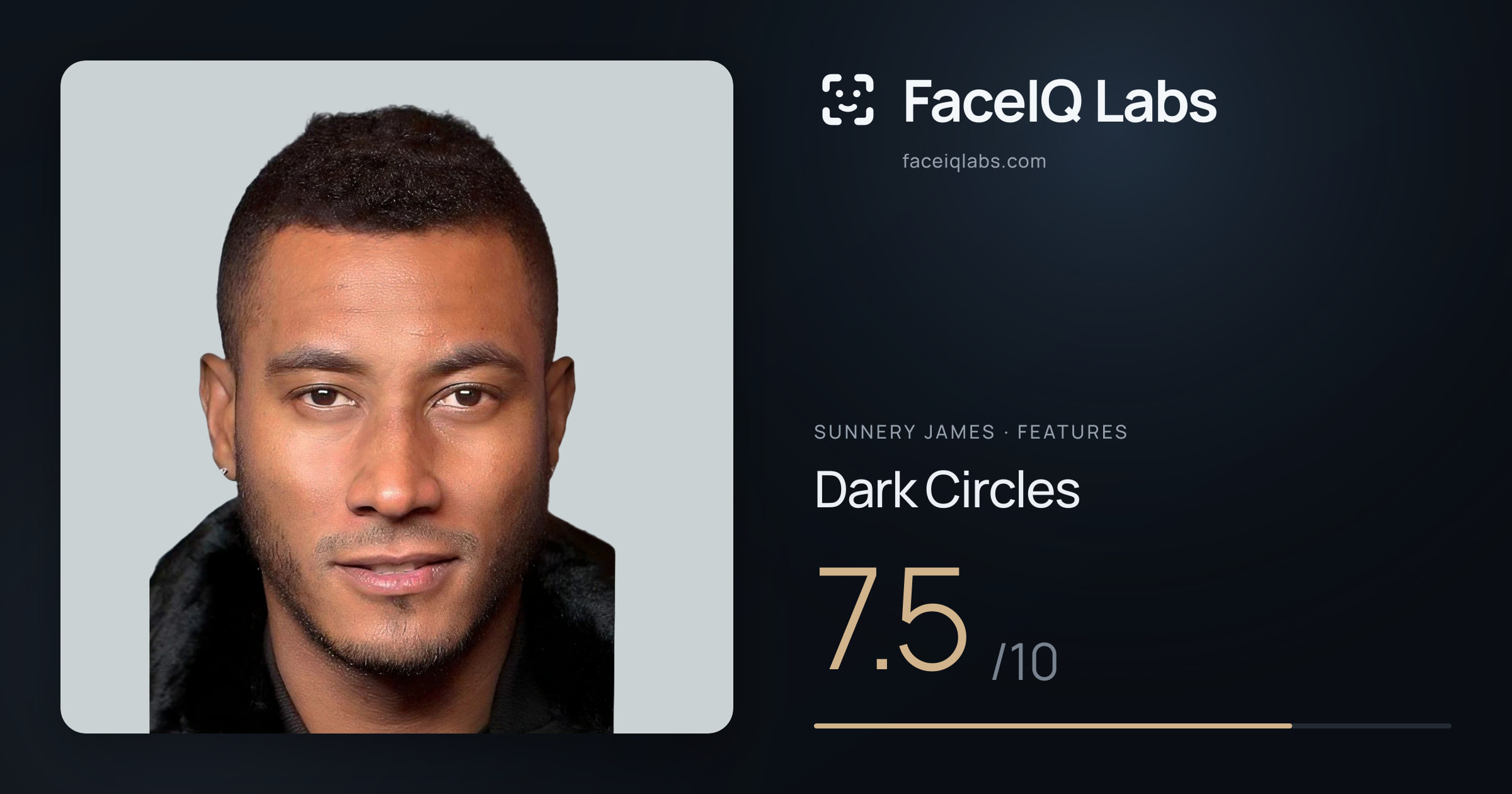 Sunnery James Dark Circles: 7.5/10, drawn on the photo