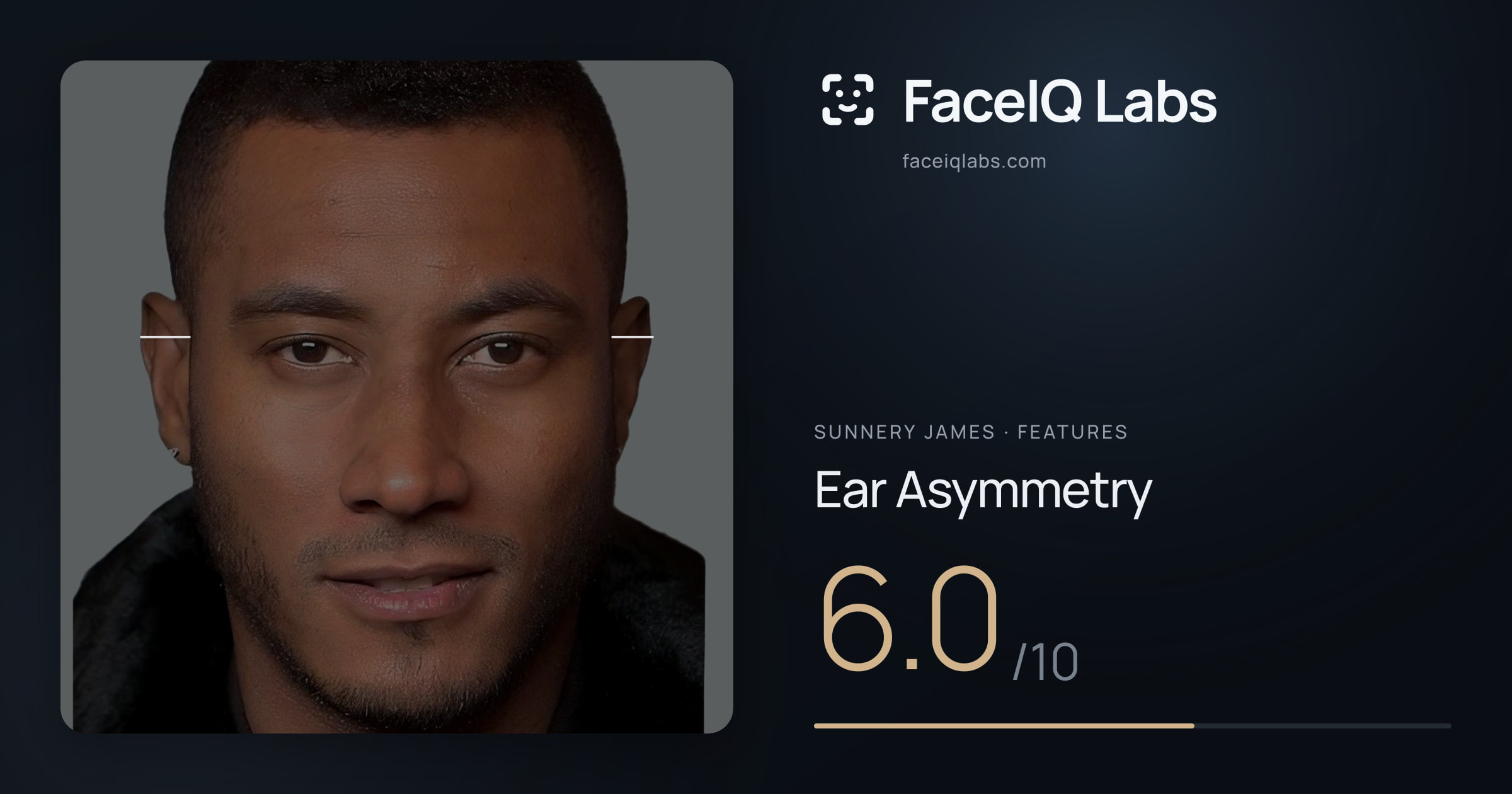 Sunnery James Ear Asymmetry: 6.0/10, drawn on the photo