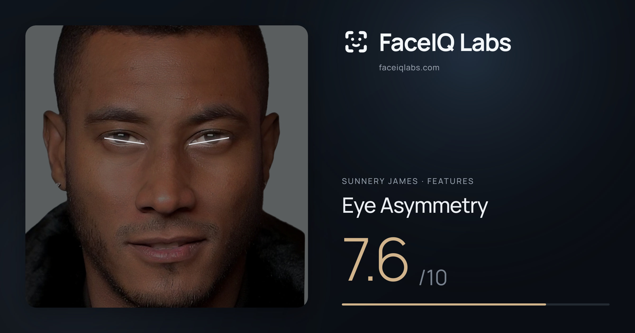 Sunnery James Eye Asymmetry: 7.6/10, drawn on the photo