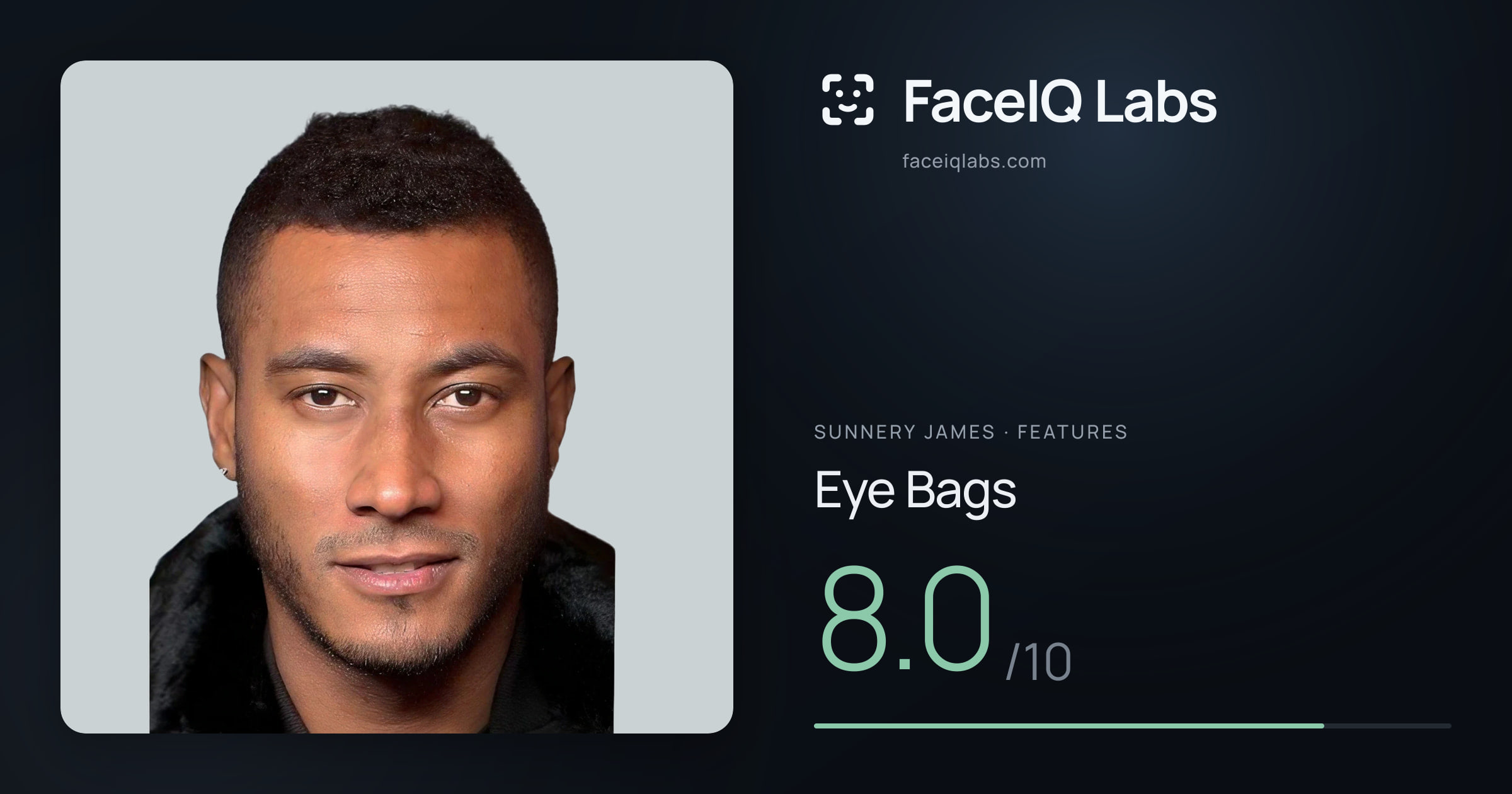 Sunnery James Eye Bags: 8.0/10, drawn on the photo