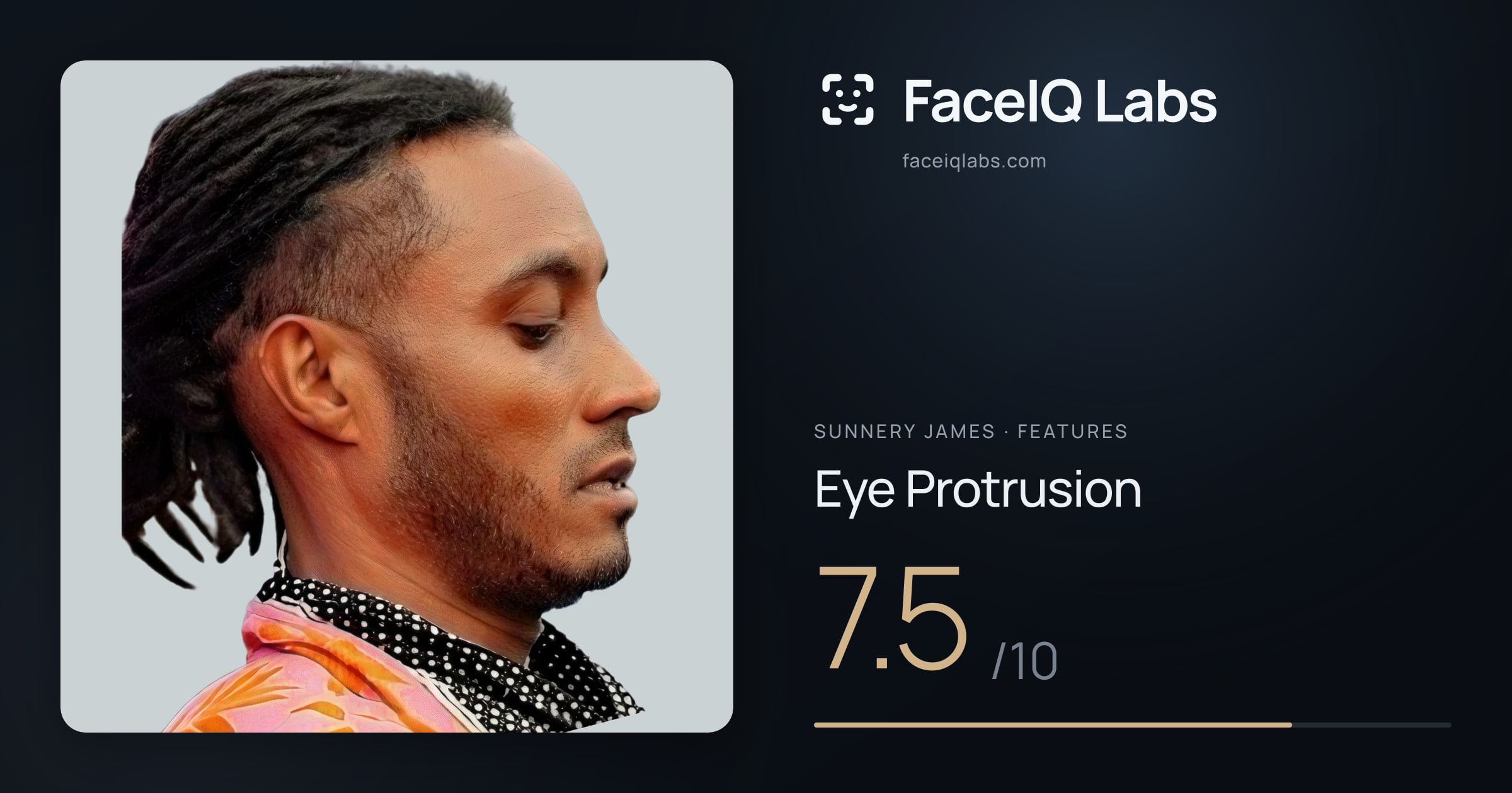 Sunnery James Eye Protrusion: 7.5/10, drawn on the photo