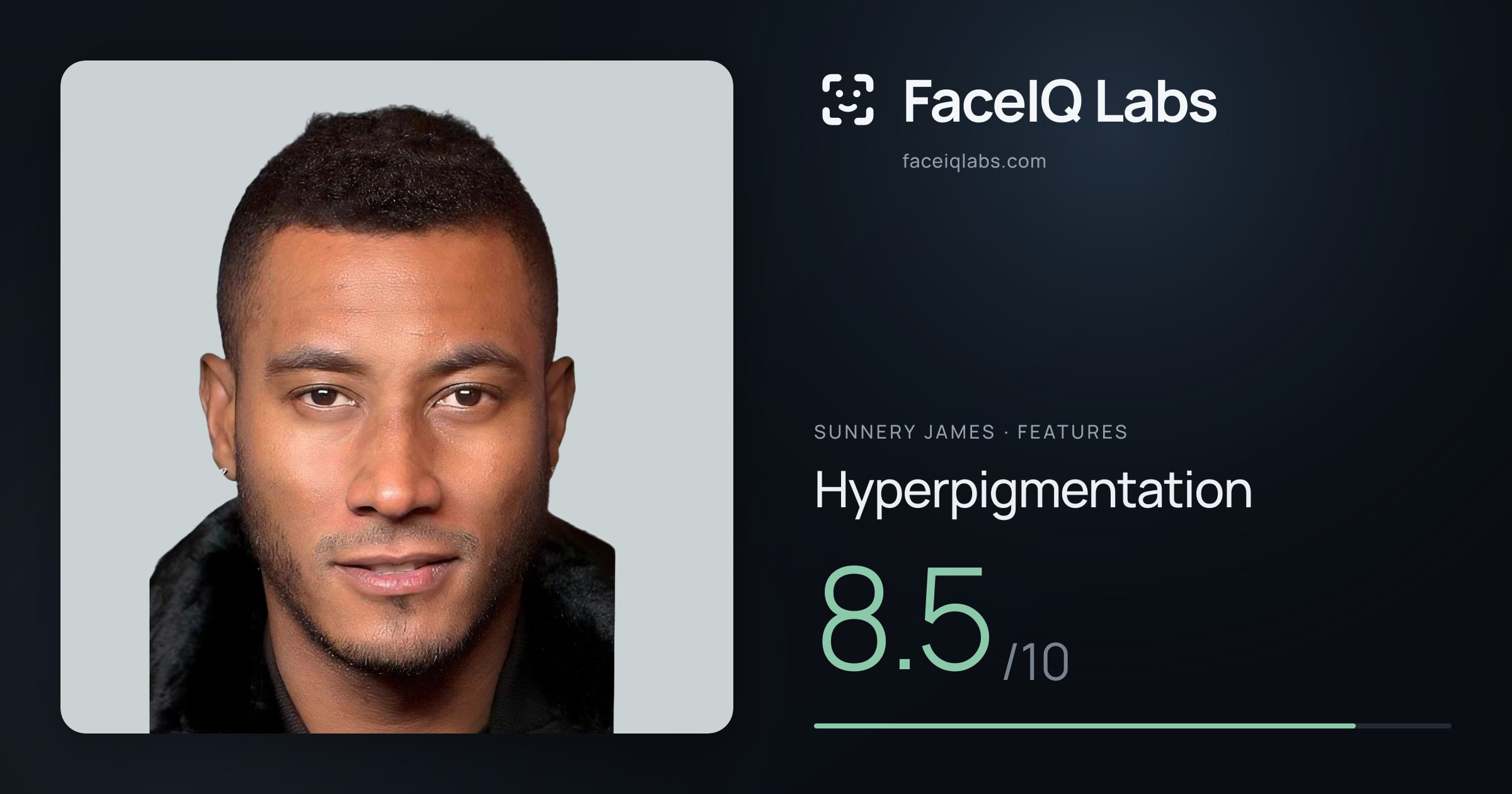 Sunnery James Hyperpigmentation: 8.5/10, drawn on the photo