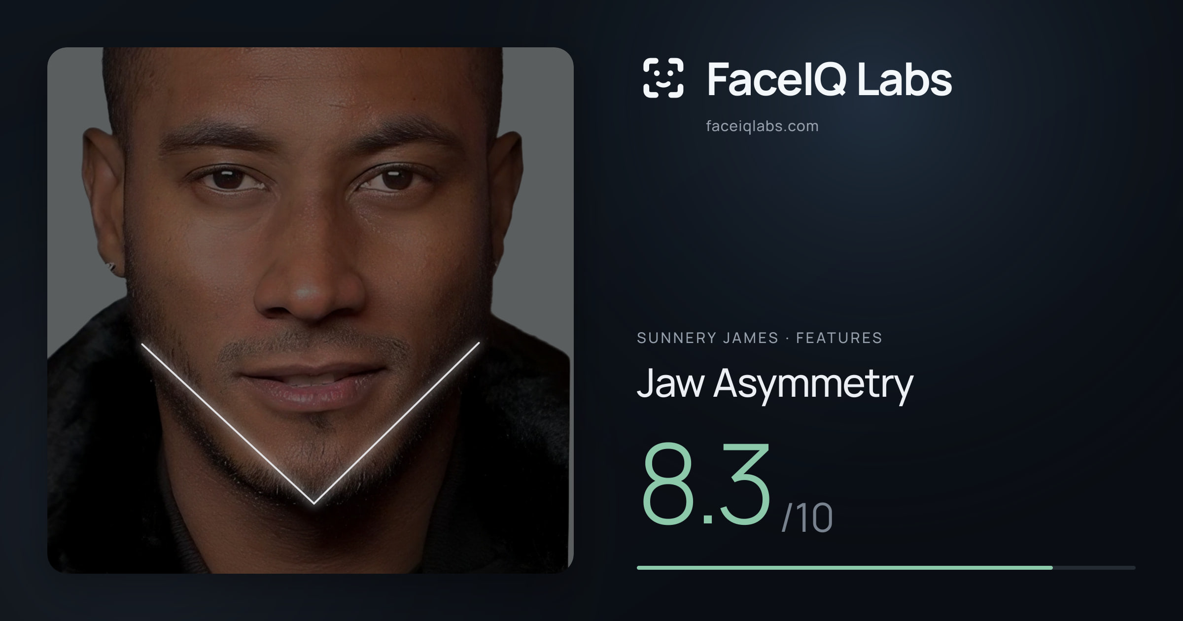 Sunnery James Jaw Asymmetry: 8.3/10, drawn on the photo