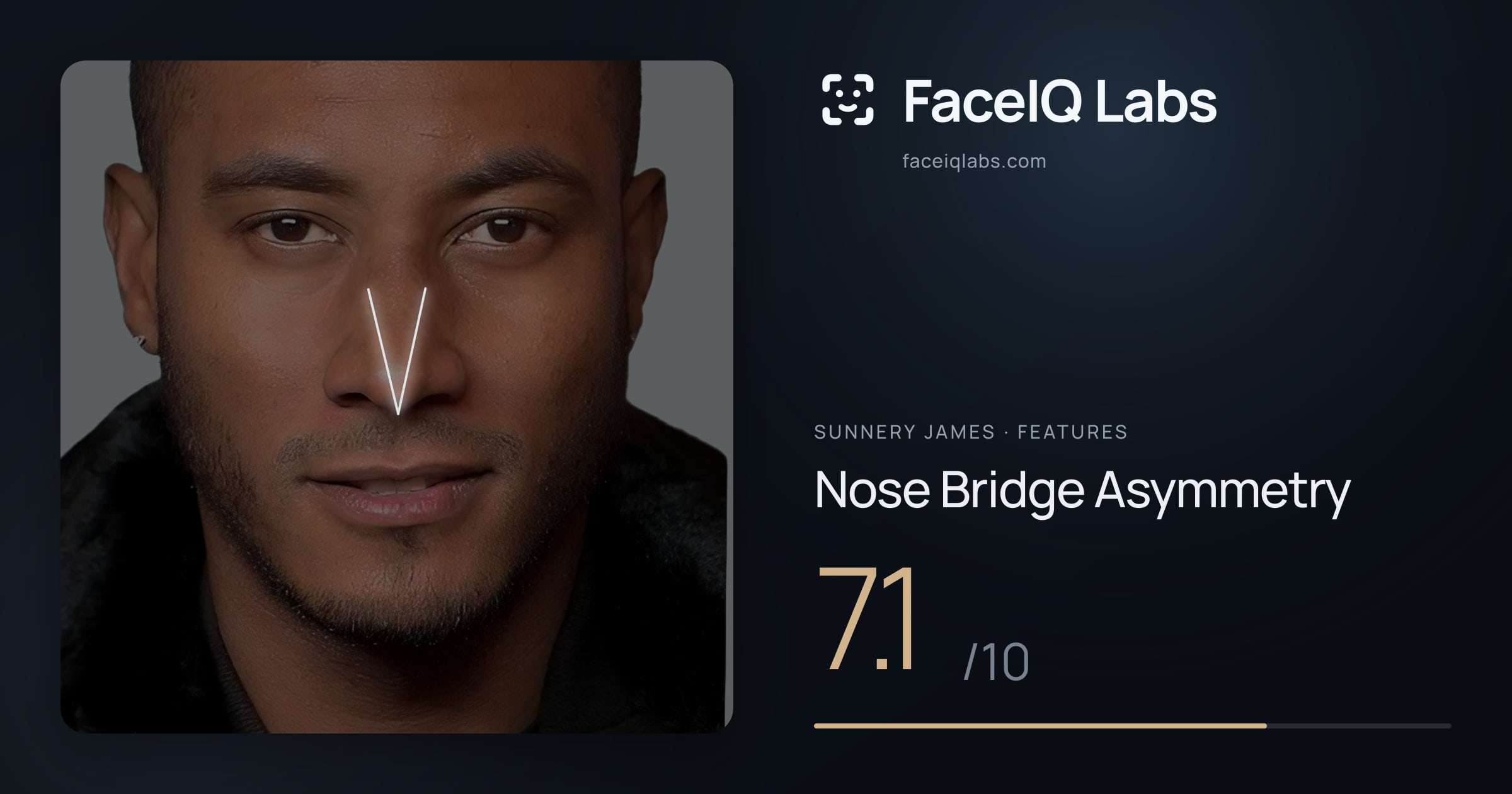 Sunnery James Nose Bridge Asymmetry: 7.1/10, drawn on the photo