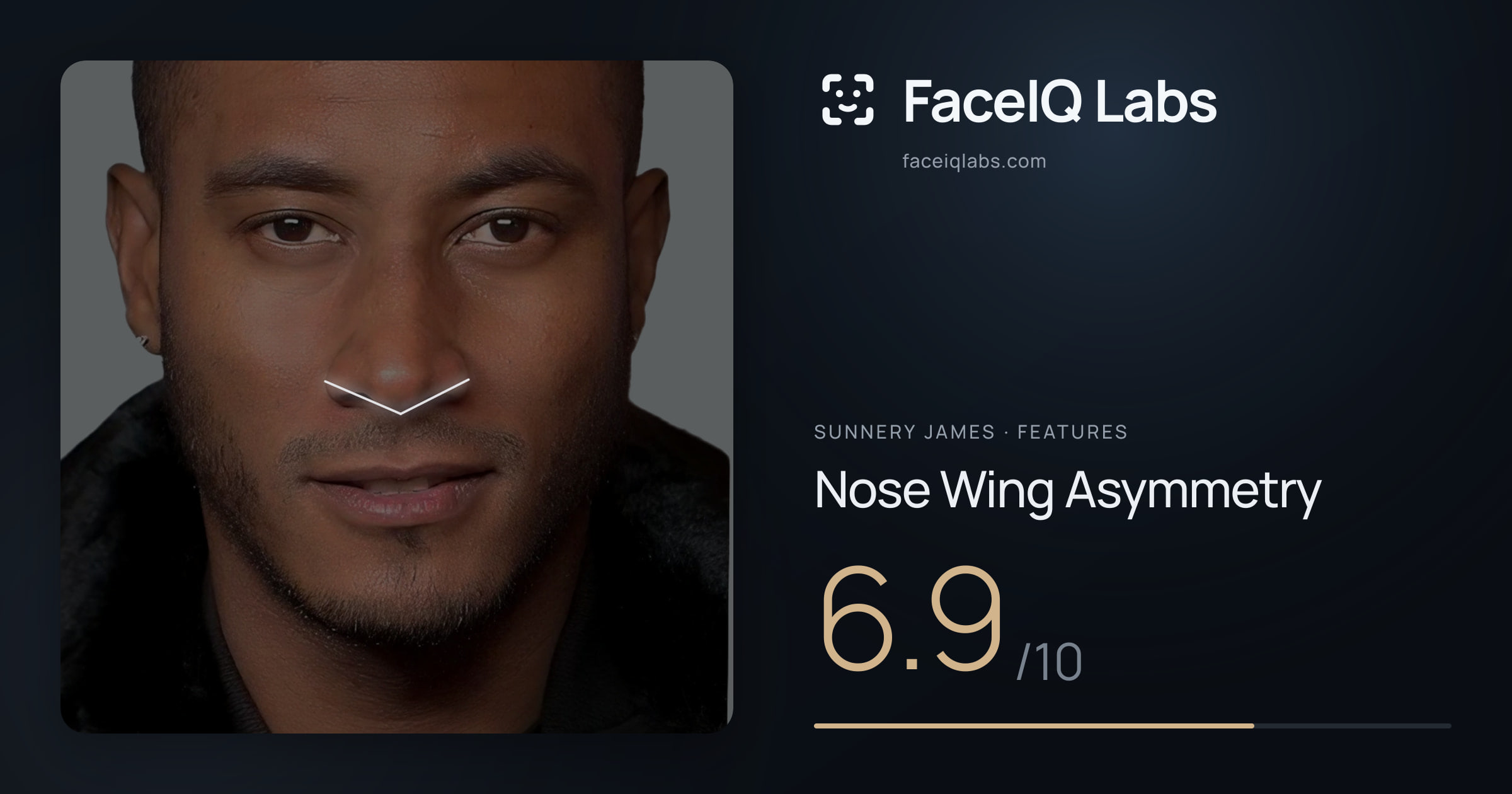 Sunnery James Nose Wing Asymmetry: 6.9/10, drawn on the photo