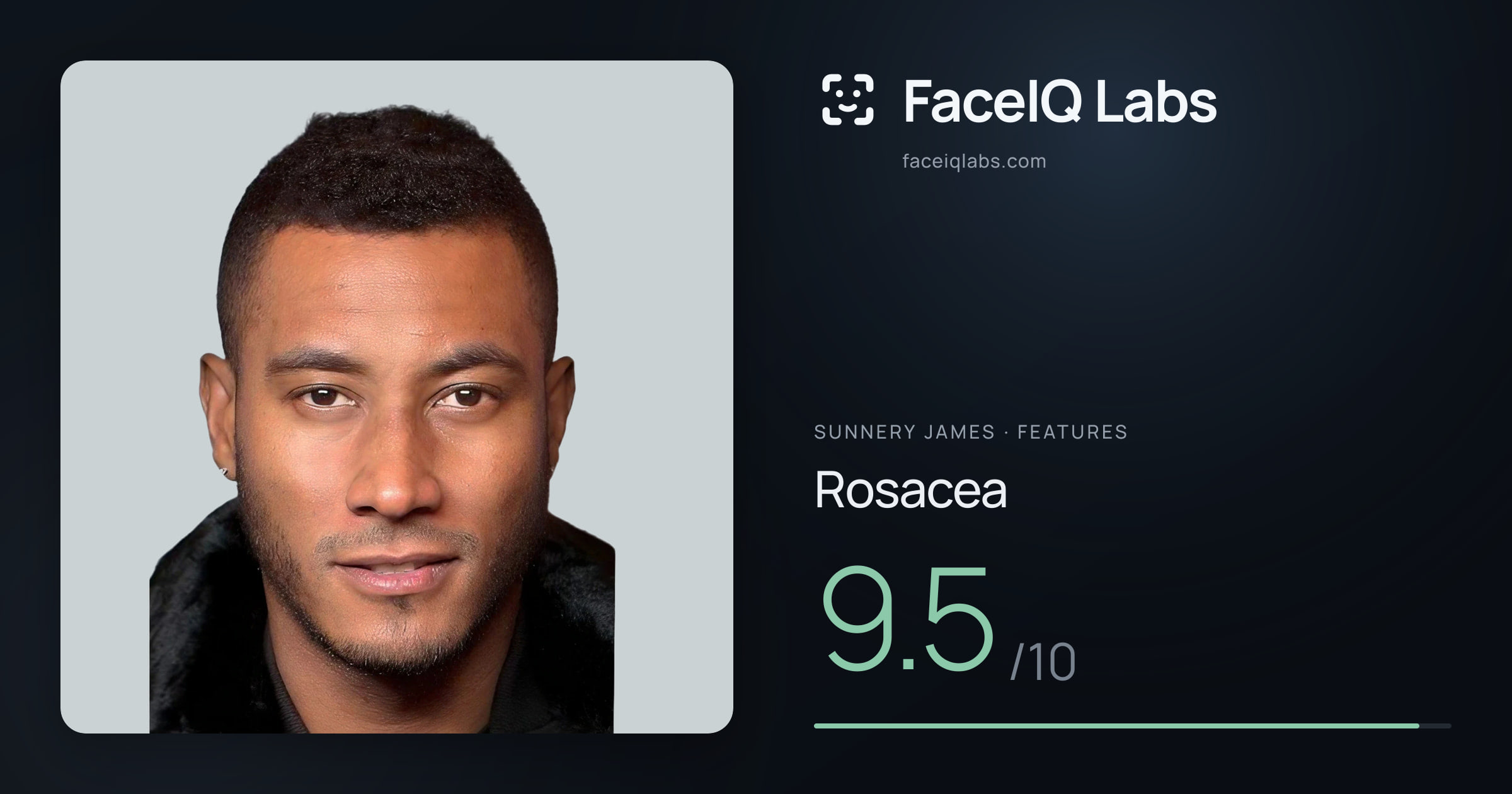 Sunnery James Rosacea: 9.5/10, drawn on the photo