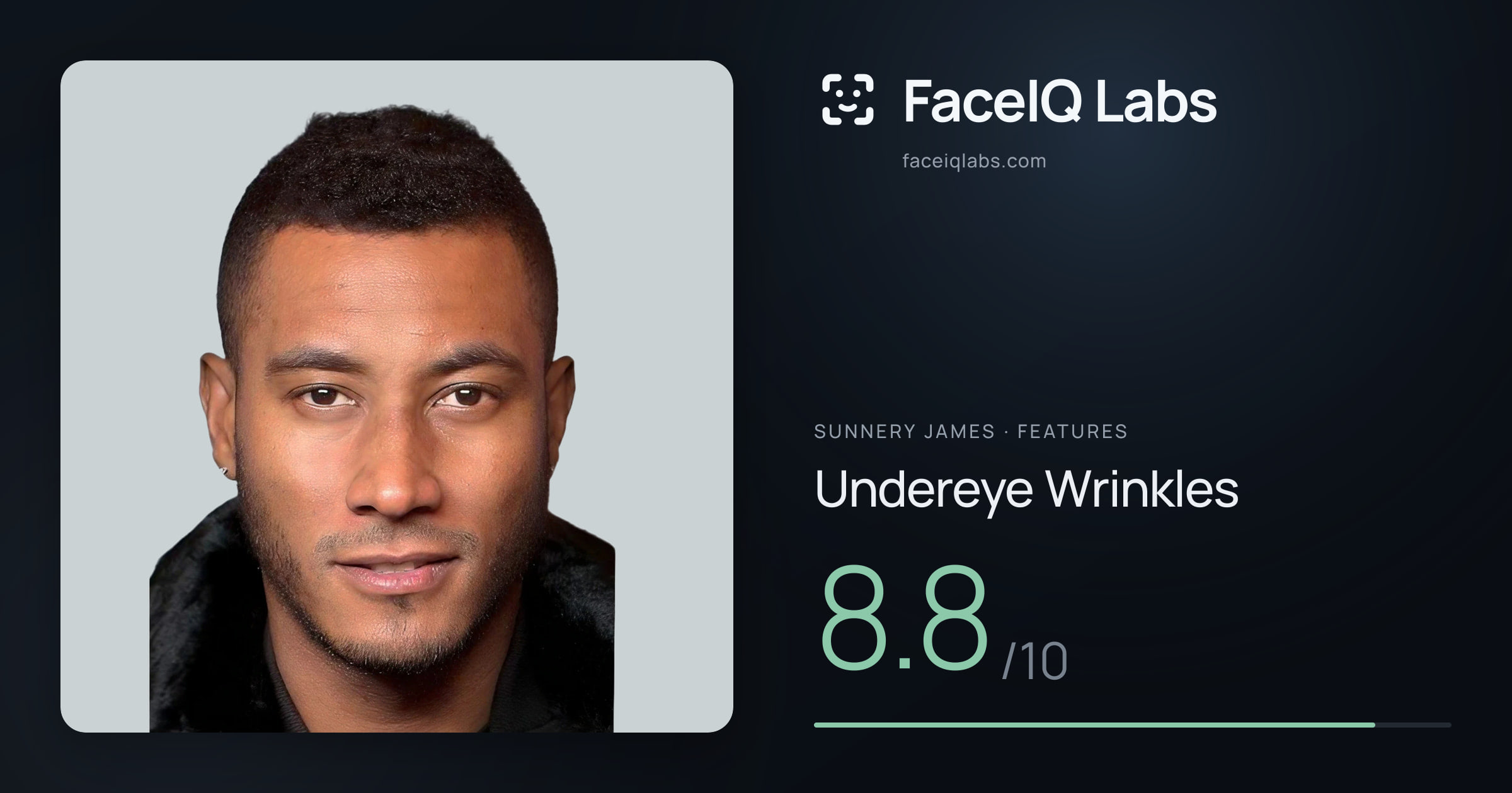 Sunnery James Undereye Wrinkles: 8.8/10, drawn on the photo