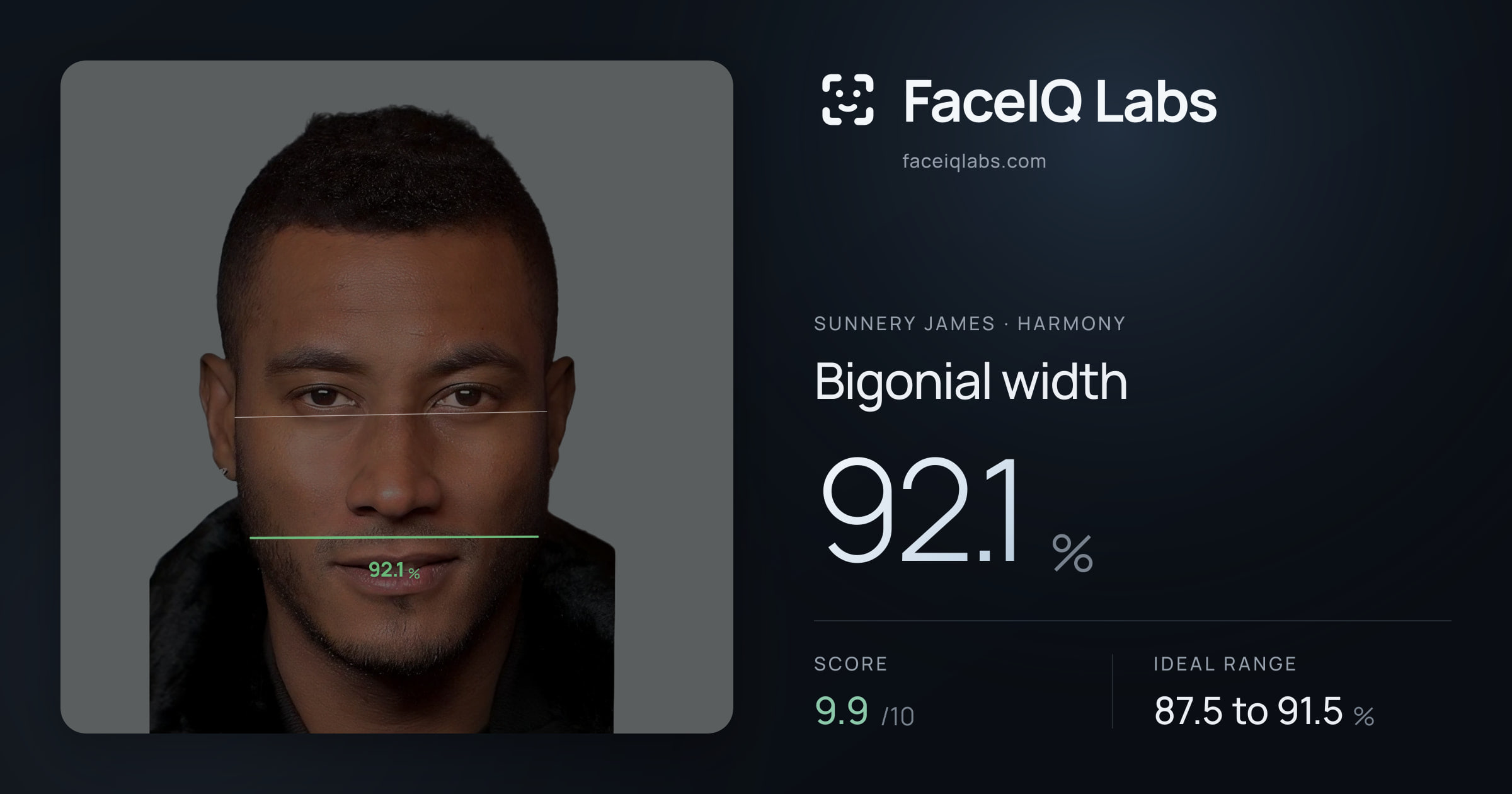 Sunnery James Bigonial width: 92.1%, drawn on the photo