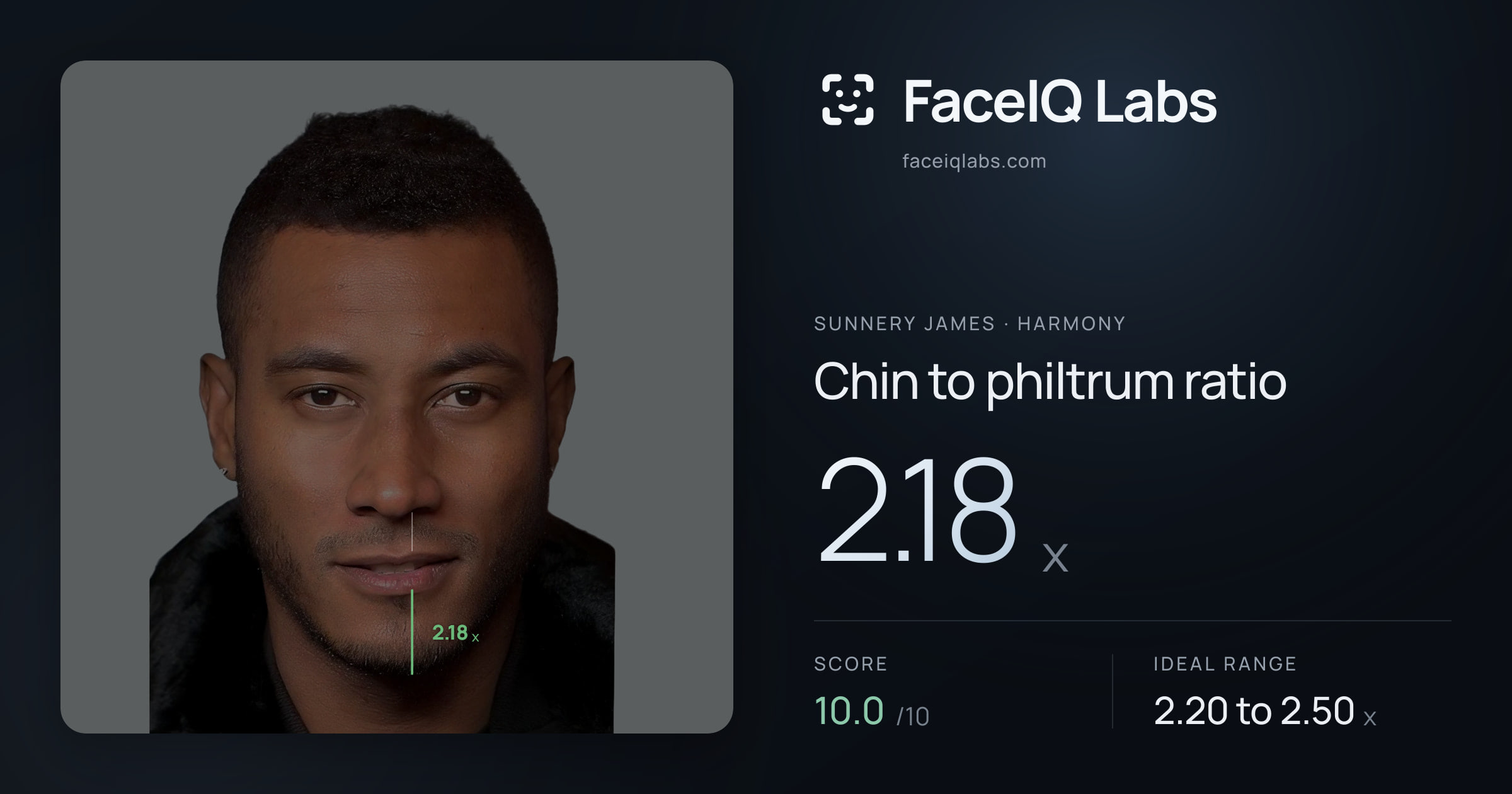Sunnery James Chin to philtrum ratio: 2.18x, drawn on the photo
