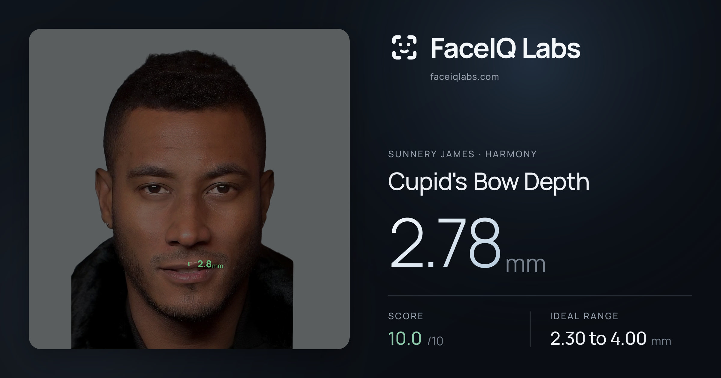 Sunnery James Cupid's Bow Depth: 2.78mm, drawn on the photo
