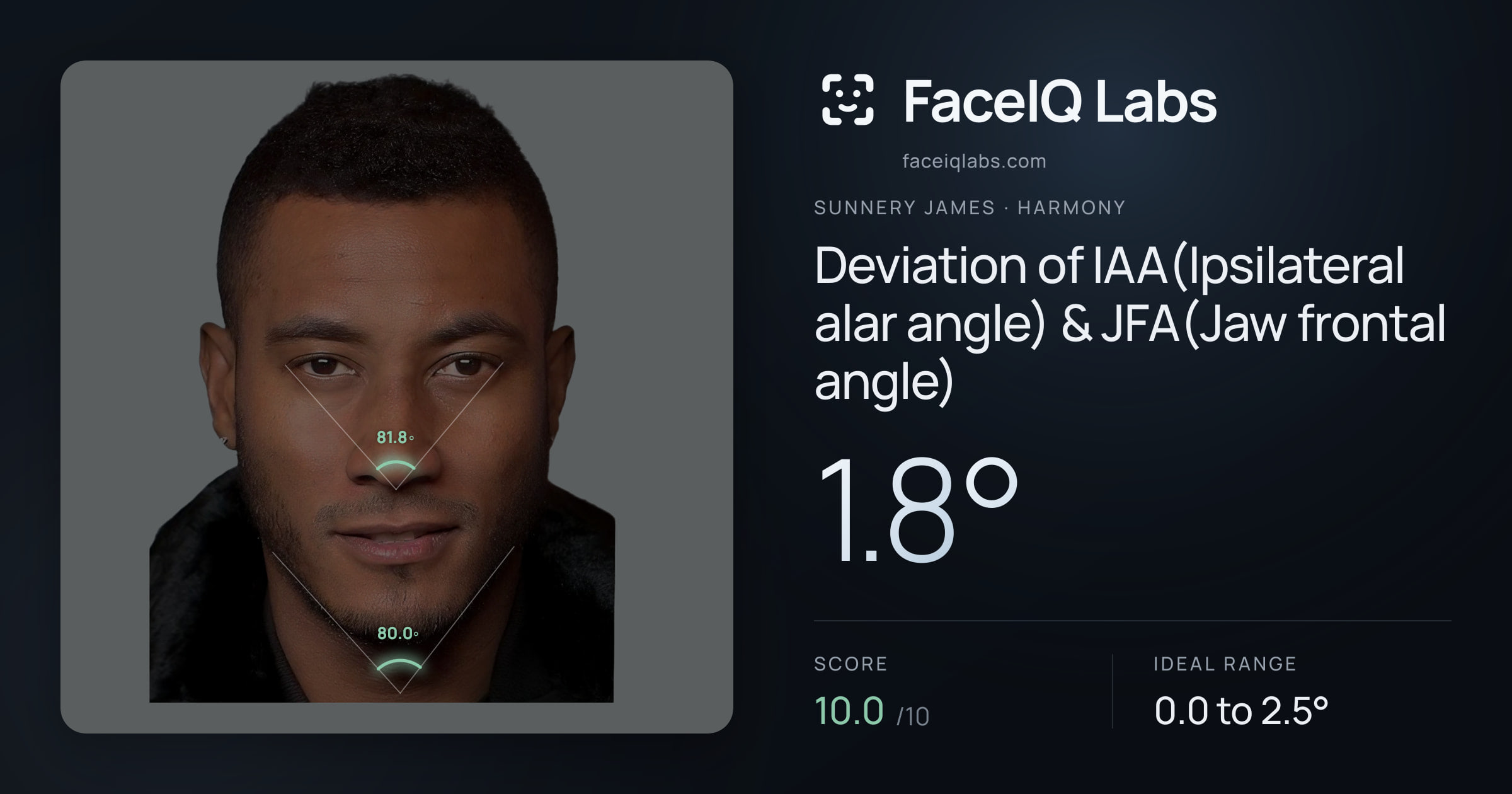 Sunnery James Deviation of IAA(Ipsilateral alar angle) & JFA(Jaw frontal angle): 1.8°, drawn on the photo