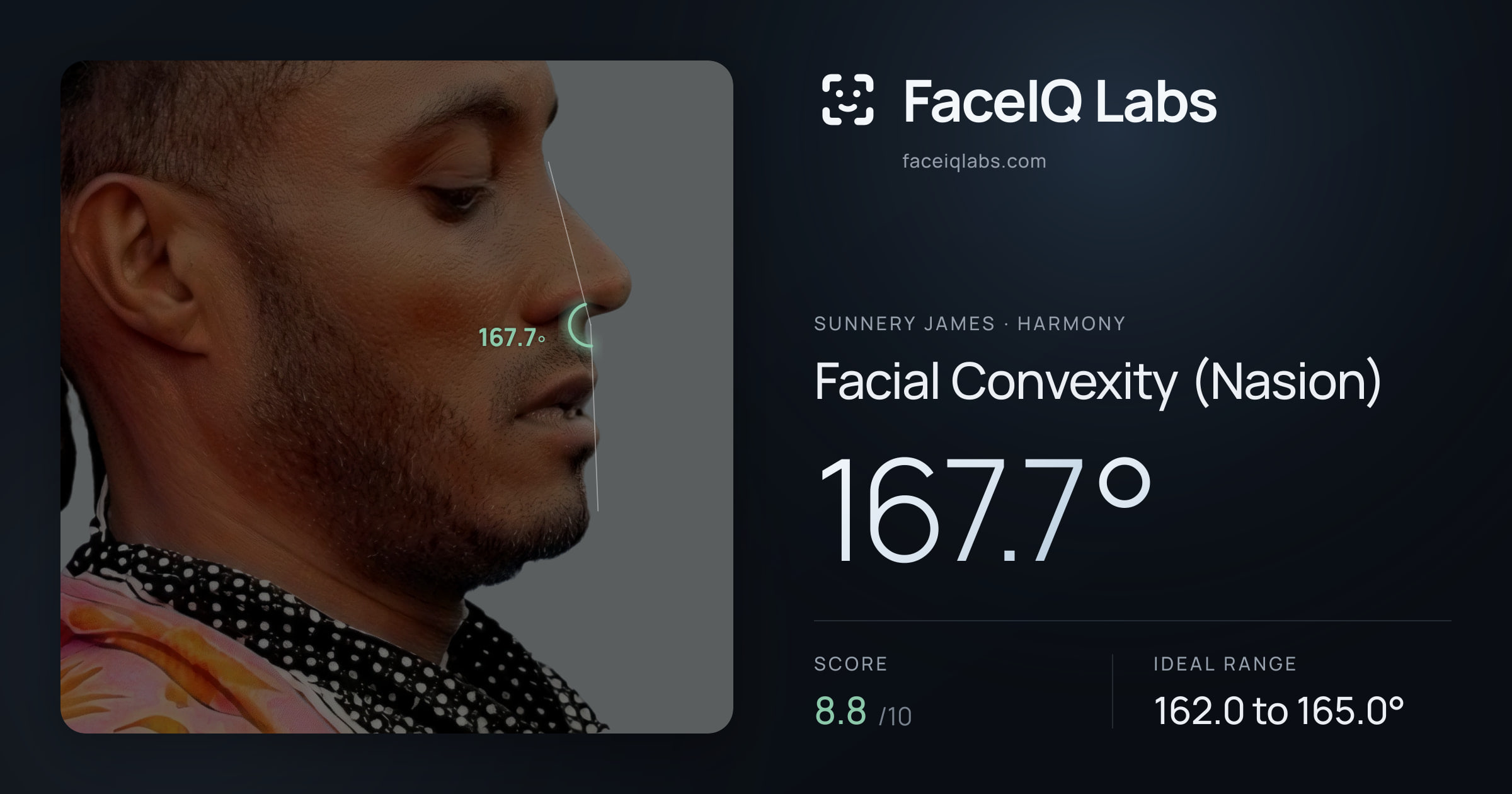 Sunnery James Facial Convexity (Nasion): 167.7°, drawn on the photo