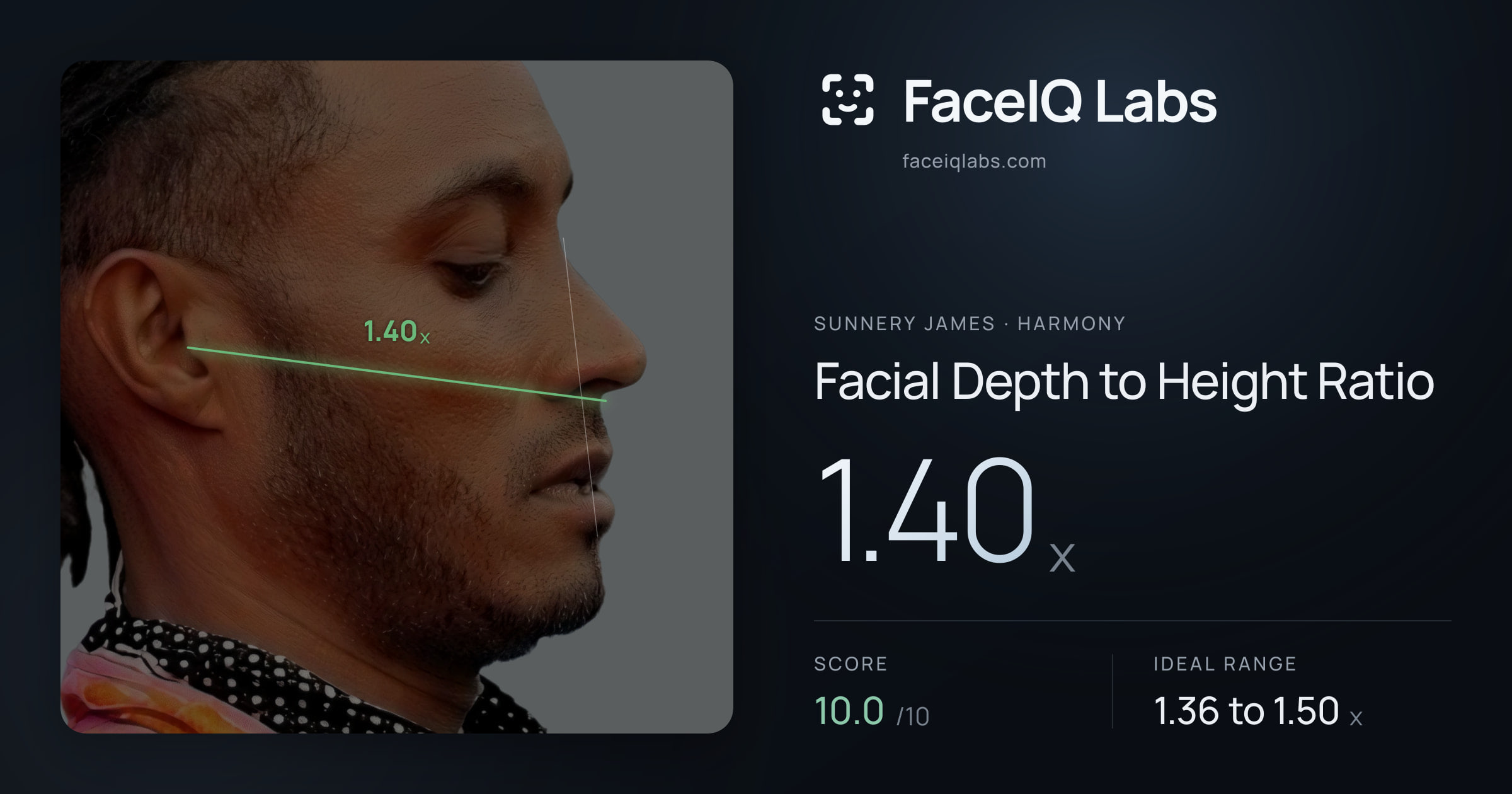 Sunnery James Facial Depth to Height Ratio: 1.40x, drawn on the photo