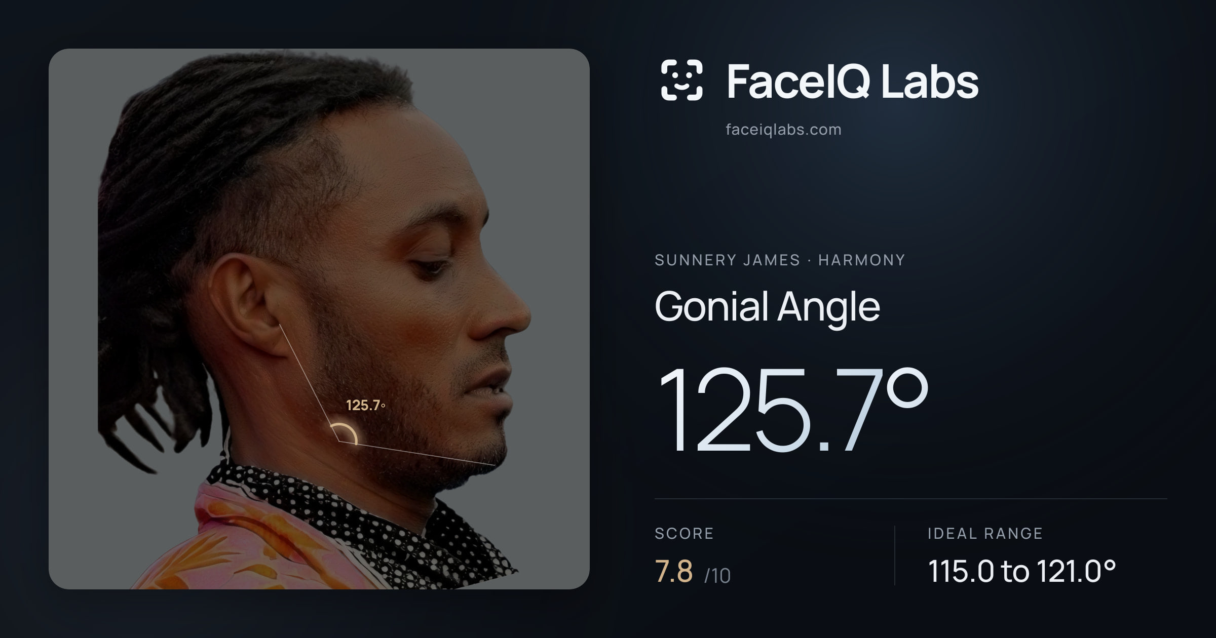Sunnery James Gonial Angle: 125.7°, drawn on the photo