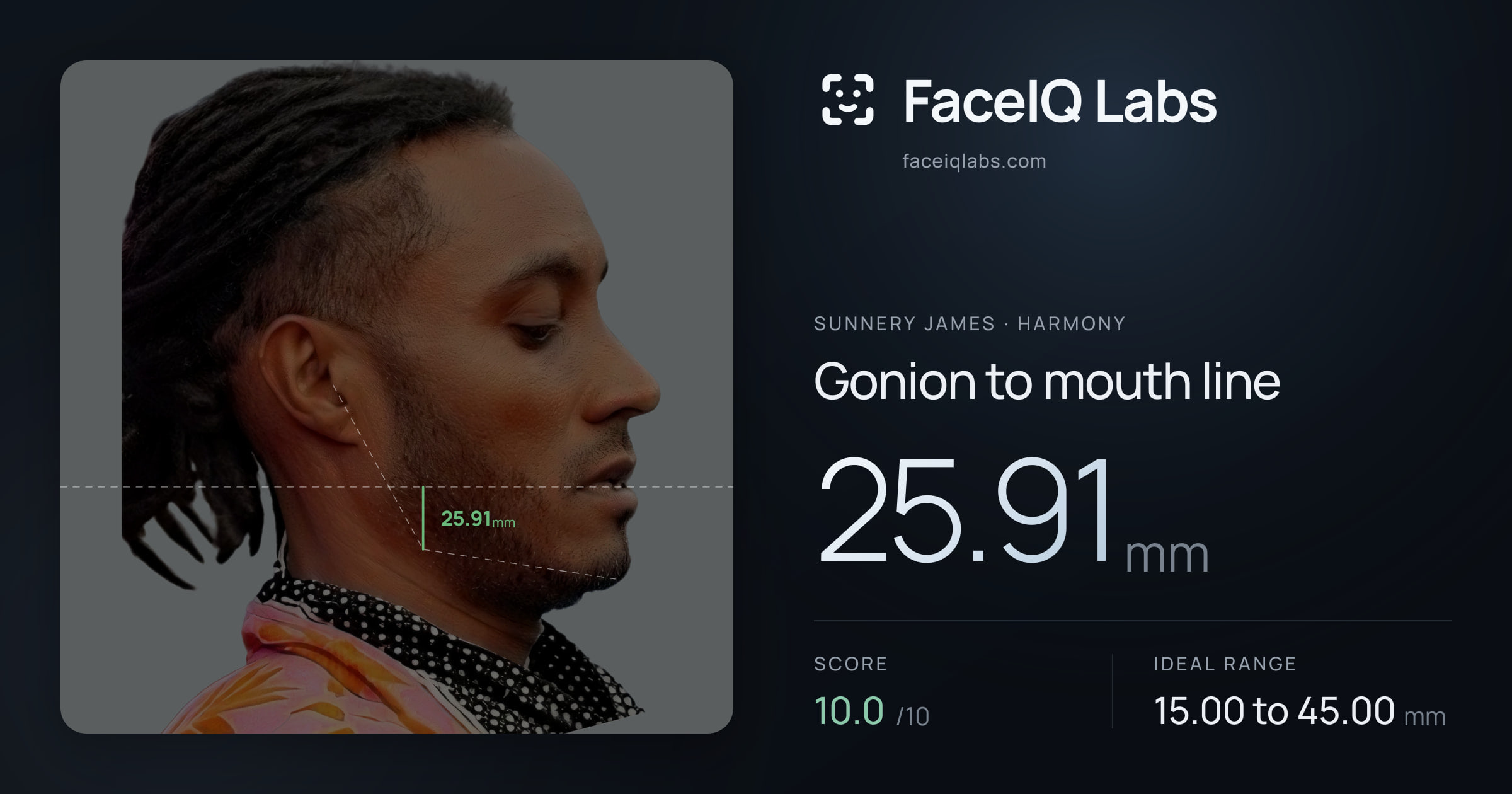 Sunnery James Gonion to mouth line: 25.91mm, drawn on the photo